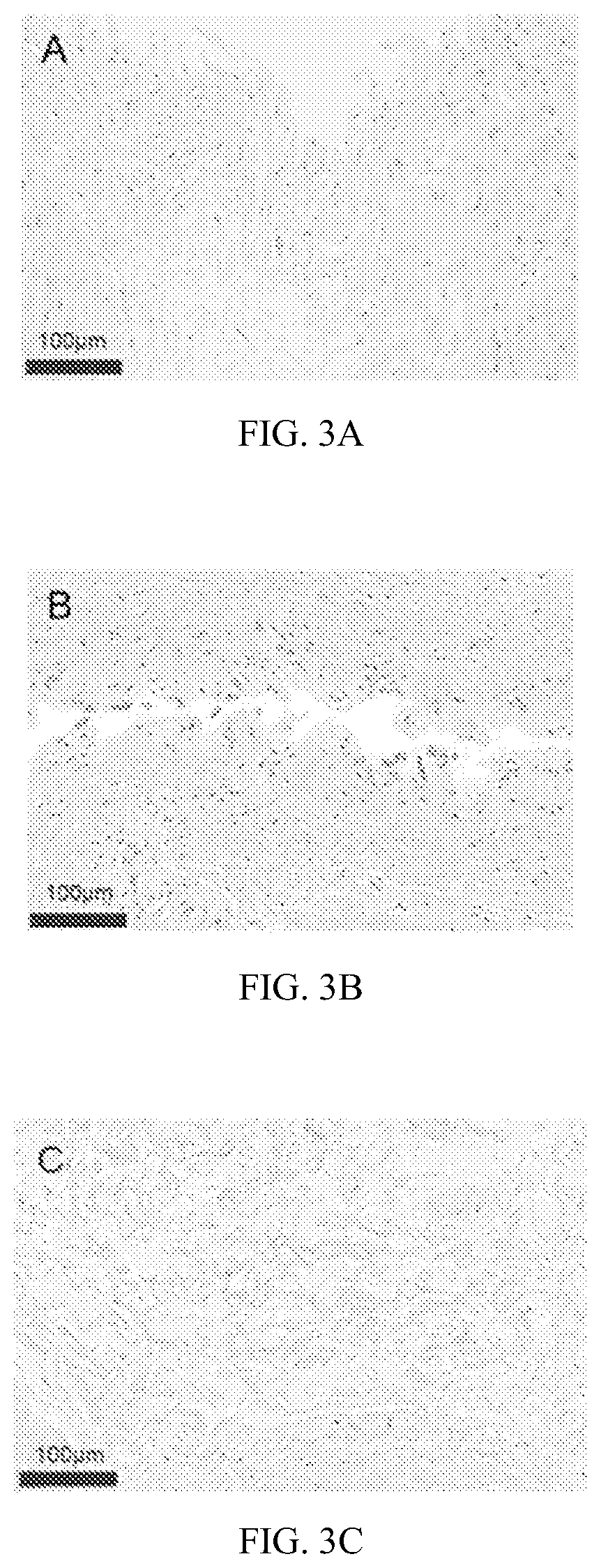 Patent US12551508 Figure 2 – Preparation method for decellularized matrix biomaterial