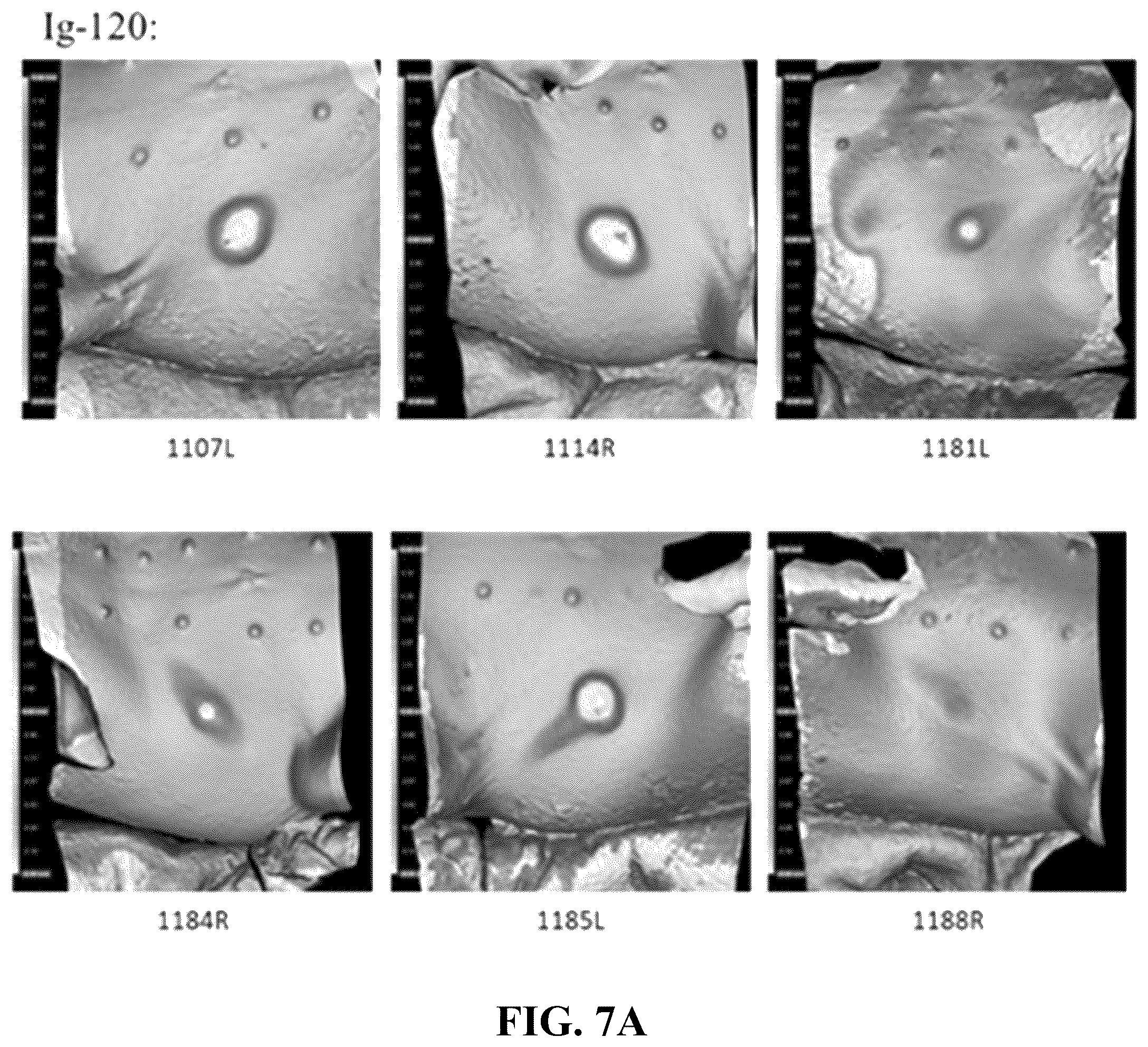Patent US12551539 Figure 4 – Hyaluronidase enzyme formulations for high volume administration