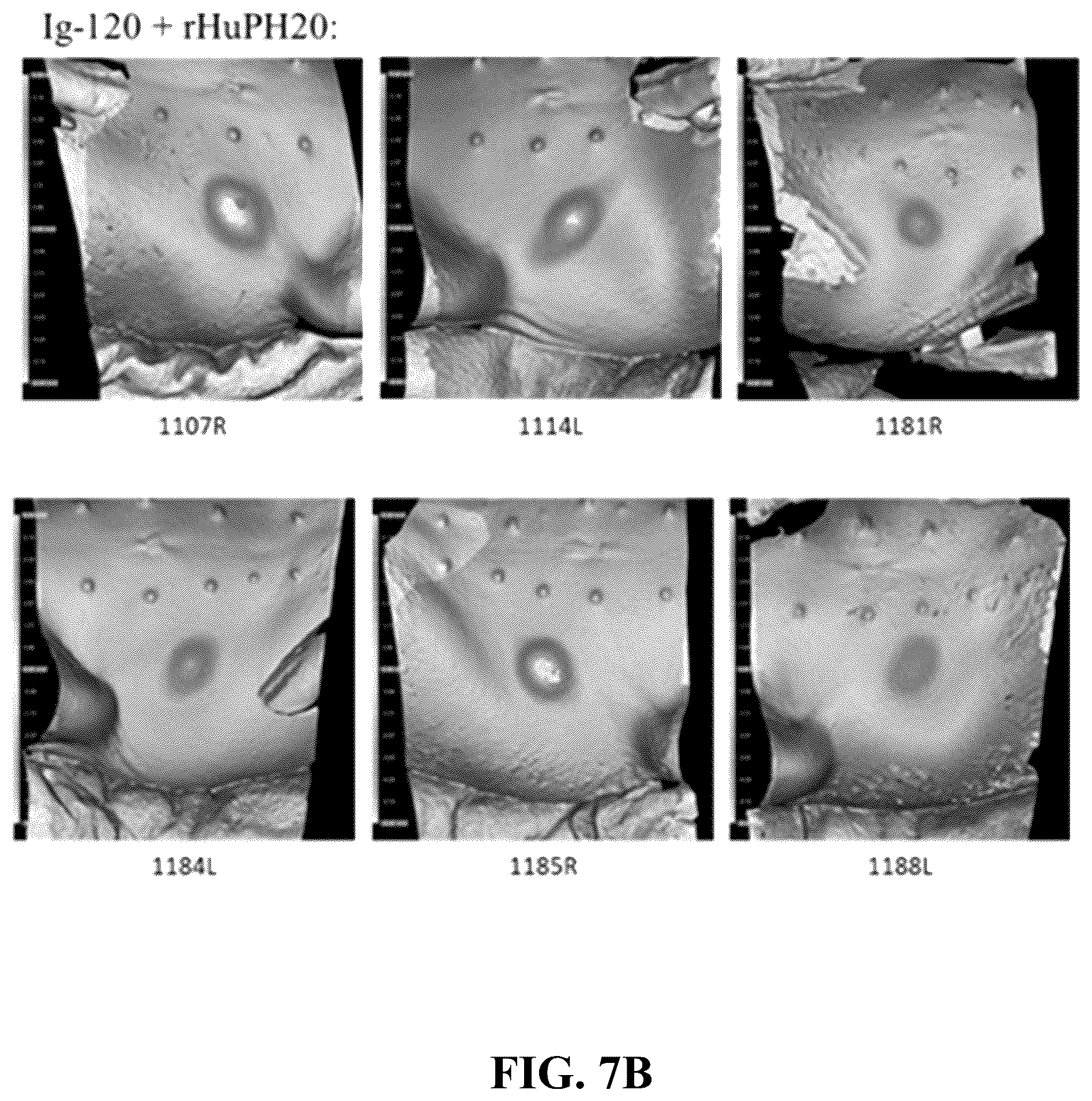 Patent US12551539 Figure 5 – Hyaluronidase enzyme formulations for high volume administration