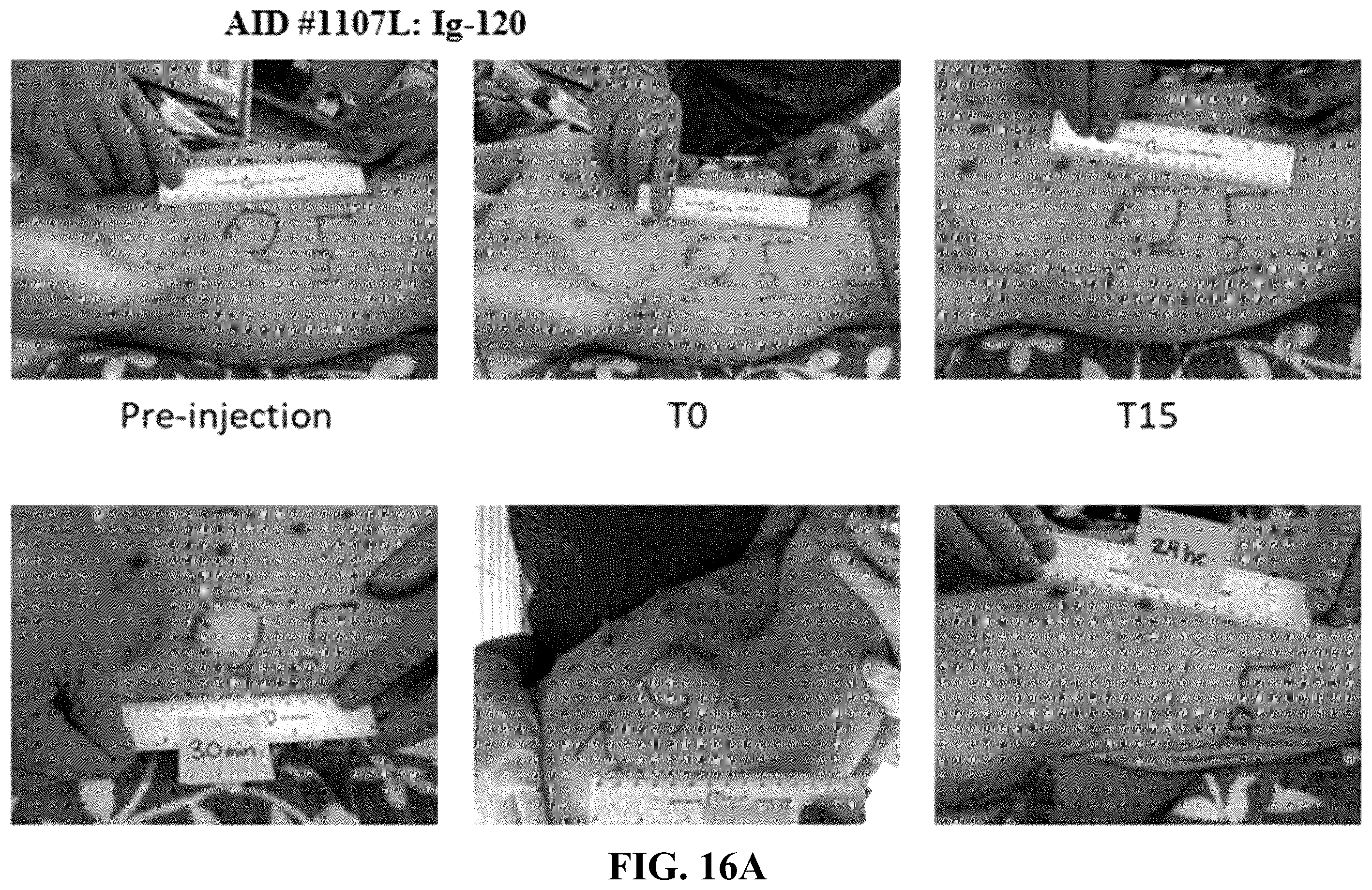 Patent US12551539 Figure 11 – Hyaluronidase enzyme formulations for high volume administration