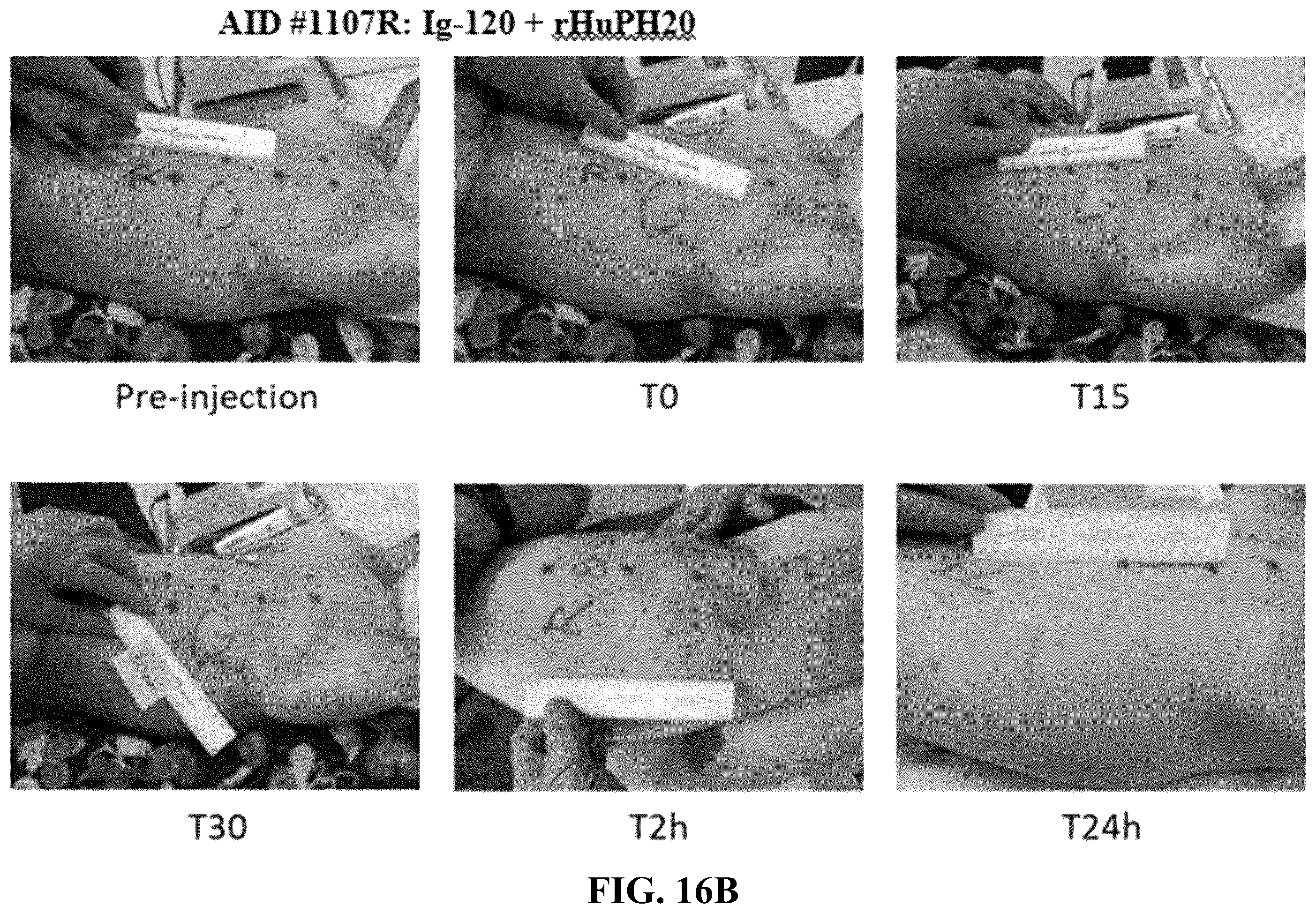 Patent US12551539 Figure 12 – Hyaluronidase enzyme formulations for high volume administration