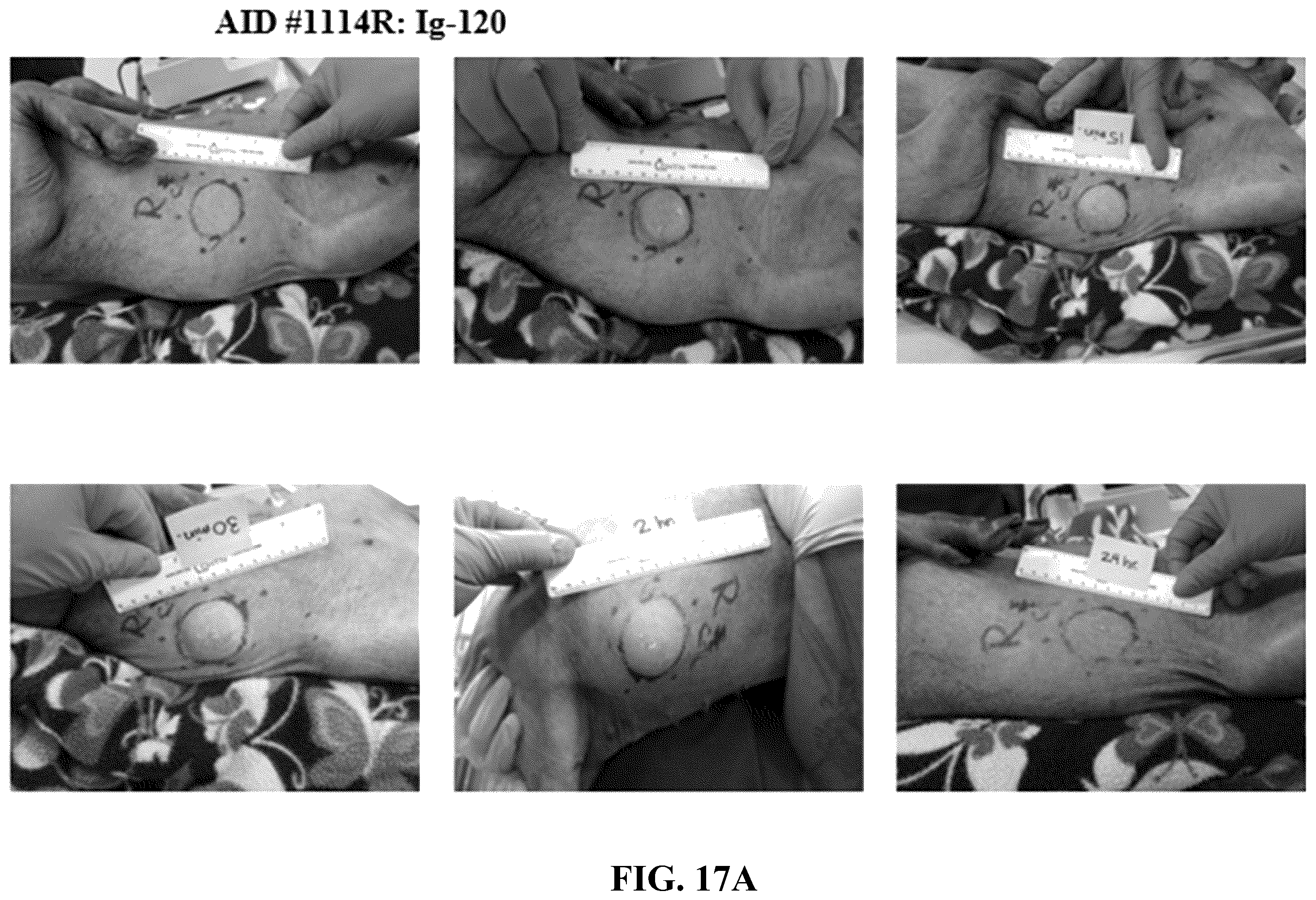 Patent US12551539 Figure 13 – Hyaluronidase enzyme formulations for high volume administration