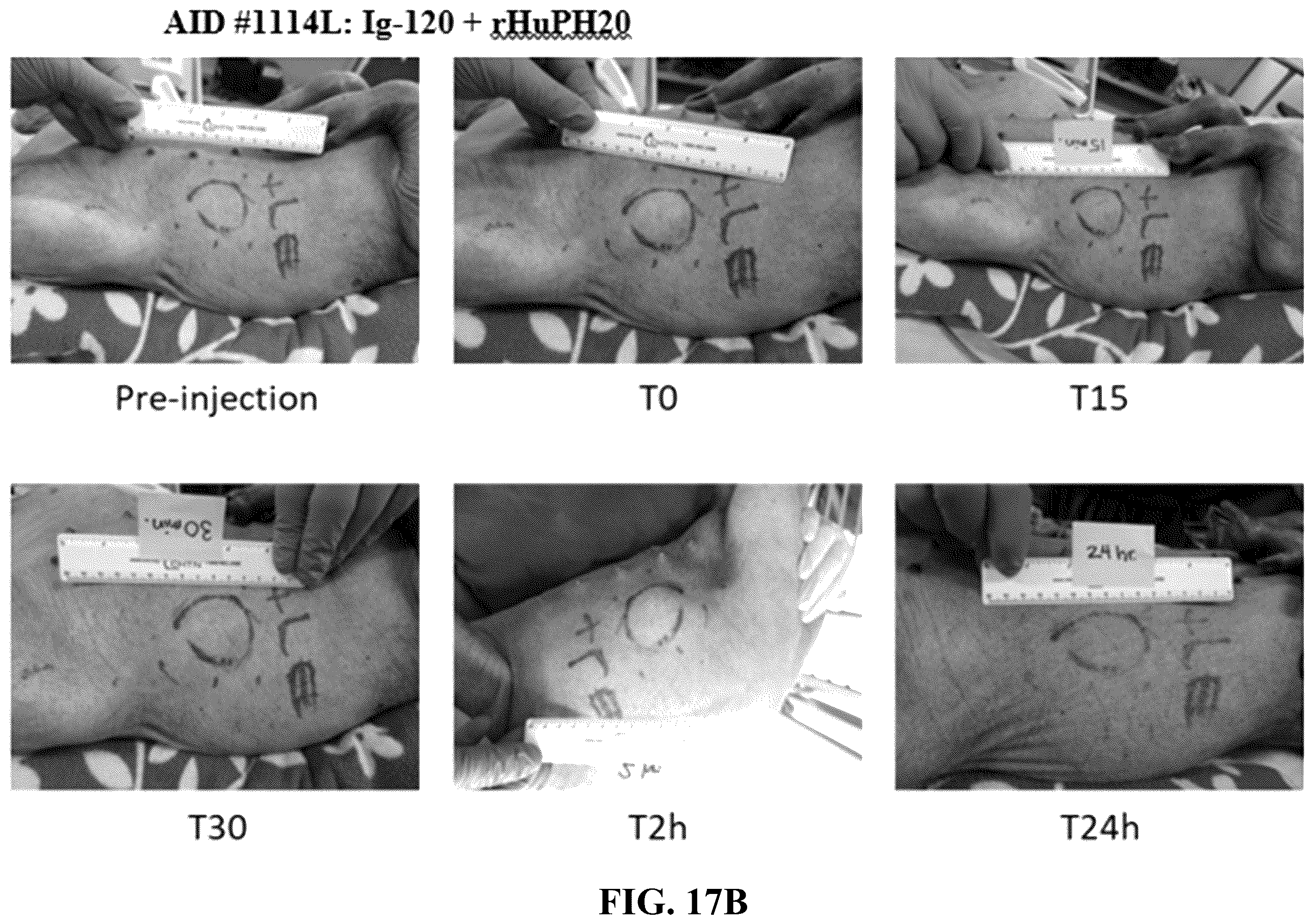 Patent US12551539 Figure 14 – Hyaluronidase enzyme formulations for high volume administration