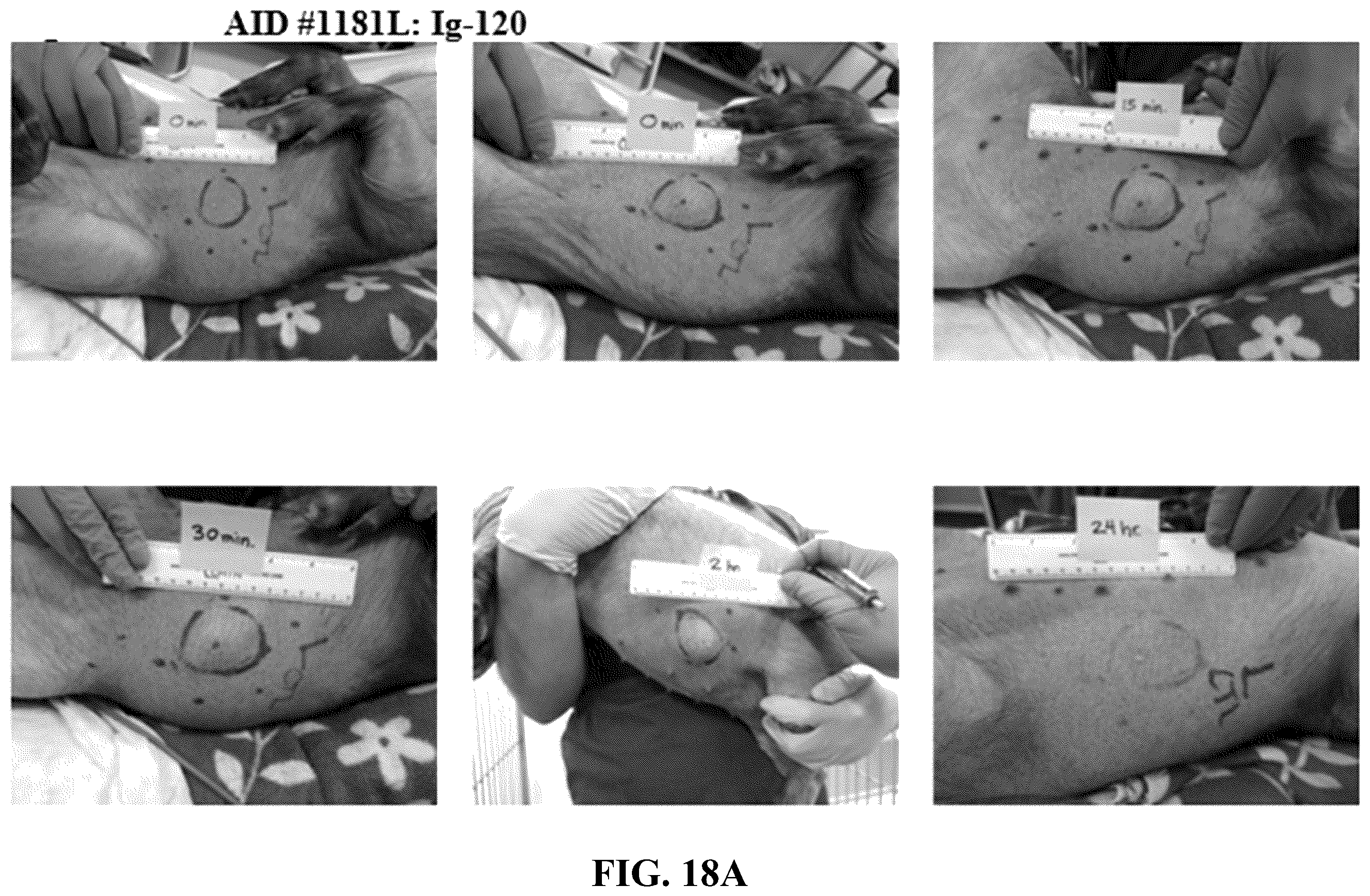 Patent US12551539 Figure 15 – Hyaluronidase enzyme formulations for high volume administration