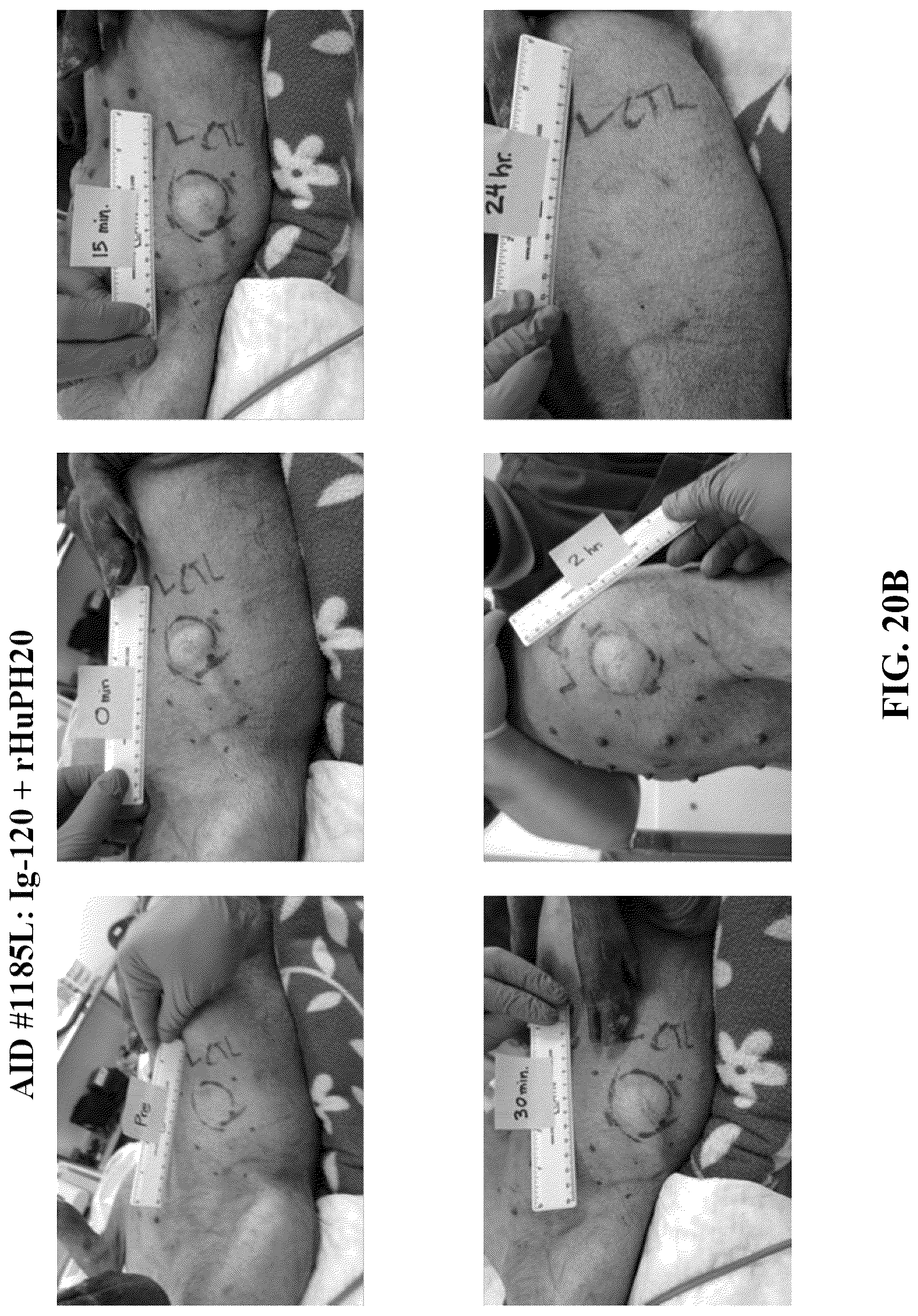 Patent US12551539 Figure 20 – Hyaluronidase enzyme formulations for high volume administration