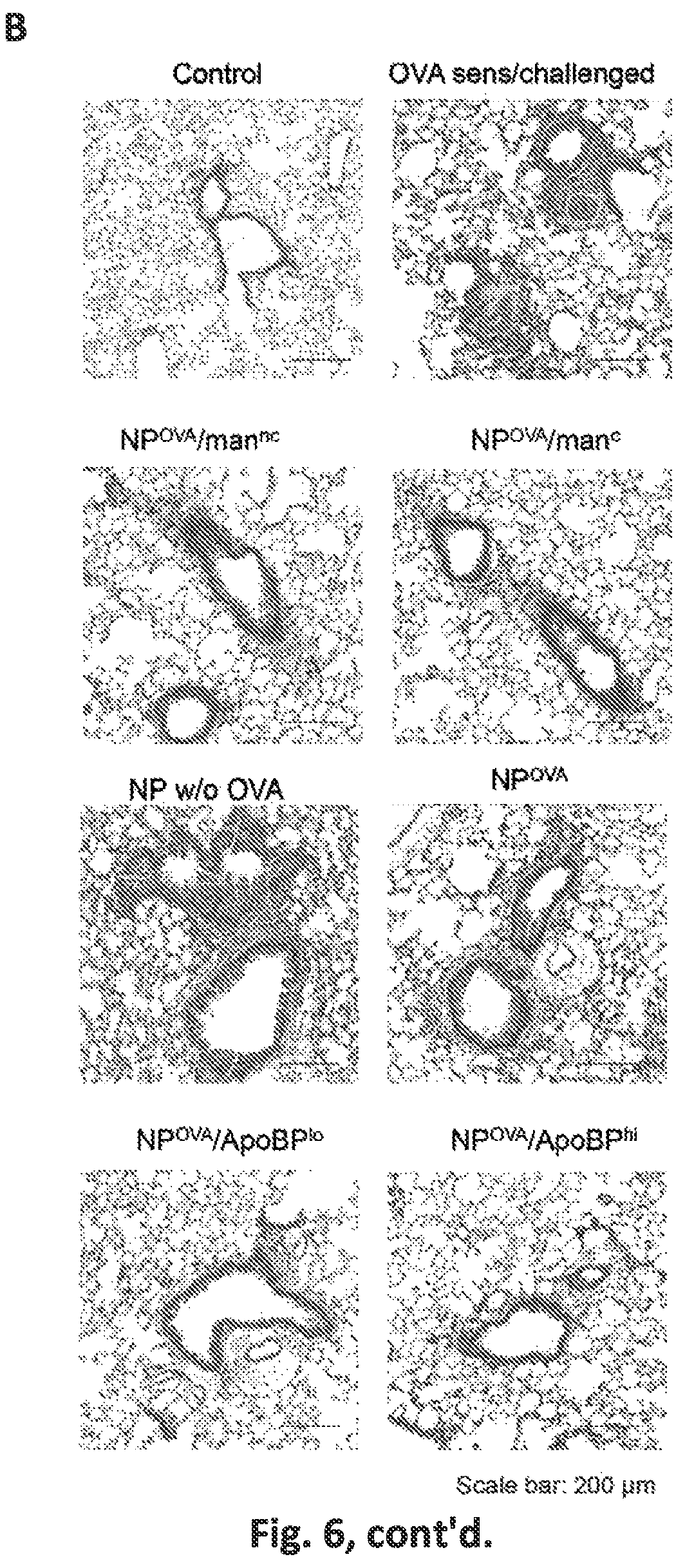 Patent US12551542 Figure 12 – Polymeric nanoparticles that target liver sinusoidal endothelial cells to induce antigen-specific immune tolerance