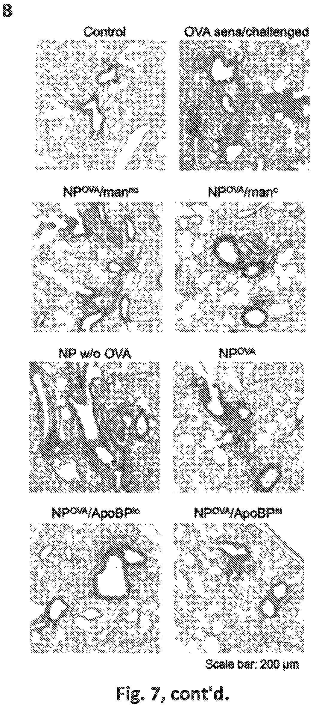 Patent US12551542 Figure 17 – Polymeric nanoparticles that target liver sinusoidal endothelial cells to induce antigen-specific immune tolerance