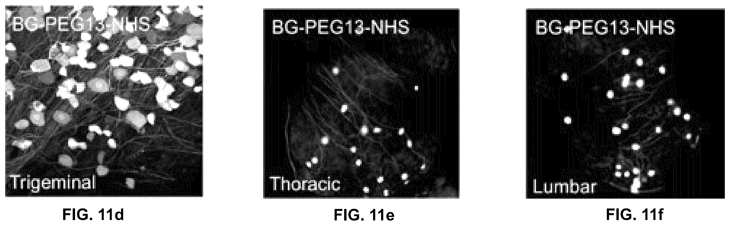 Patent US12551572 Figure 13 – Modified viral particles for gene therapy