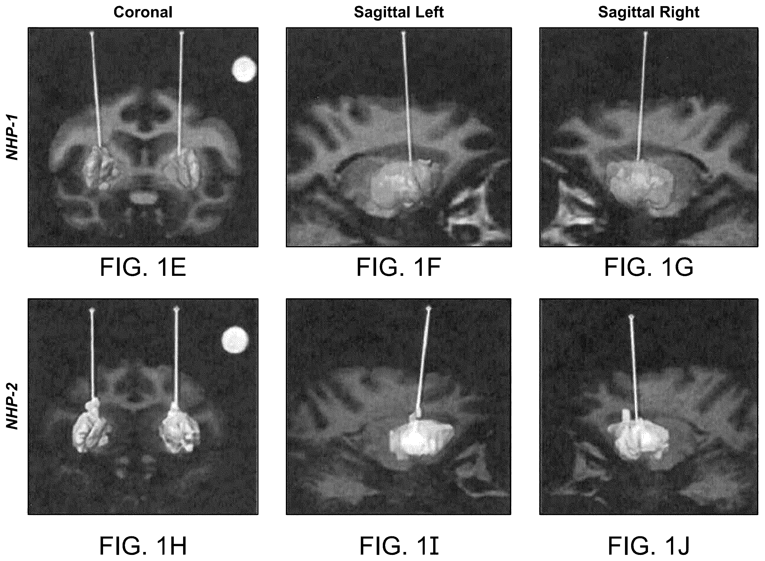 Patent US12551575 Figure 2 – Htt repressors and uses thereof