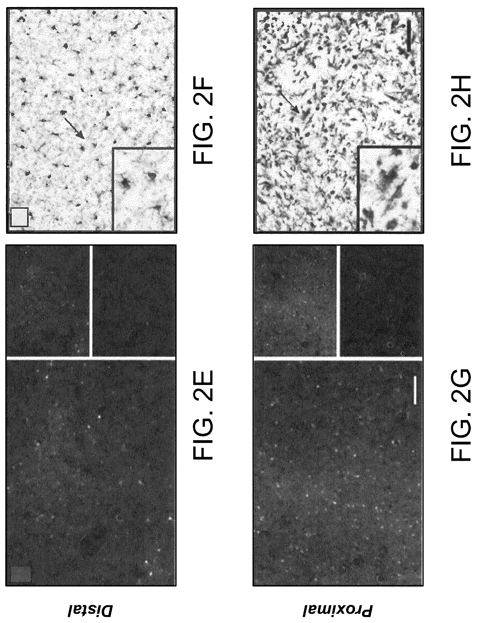 Patent US12551575 Figure 4 – Htt repressors and uses thereof