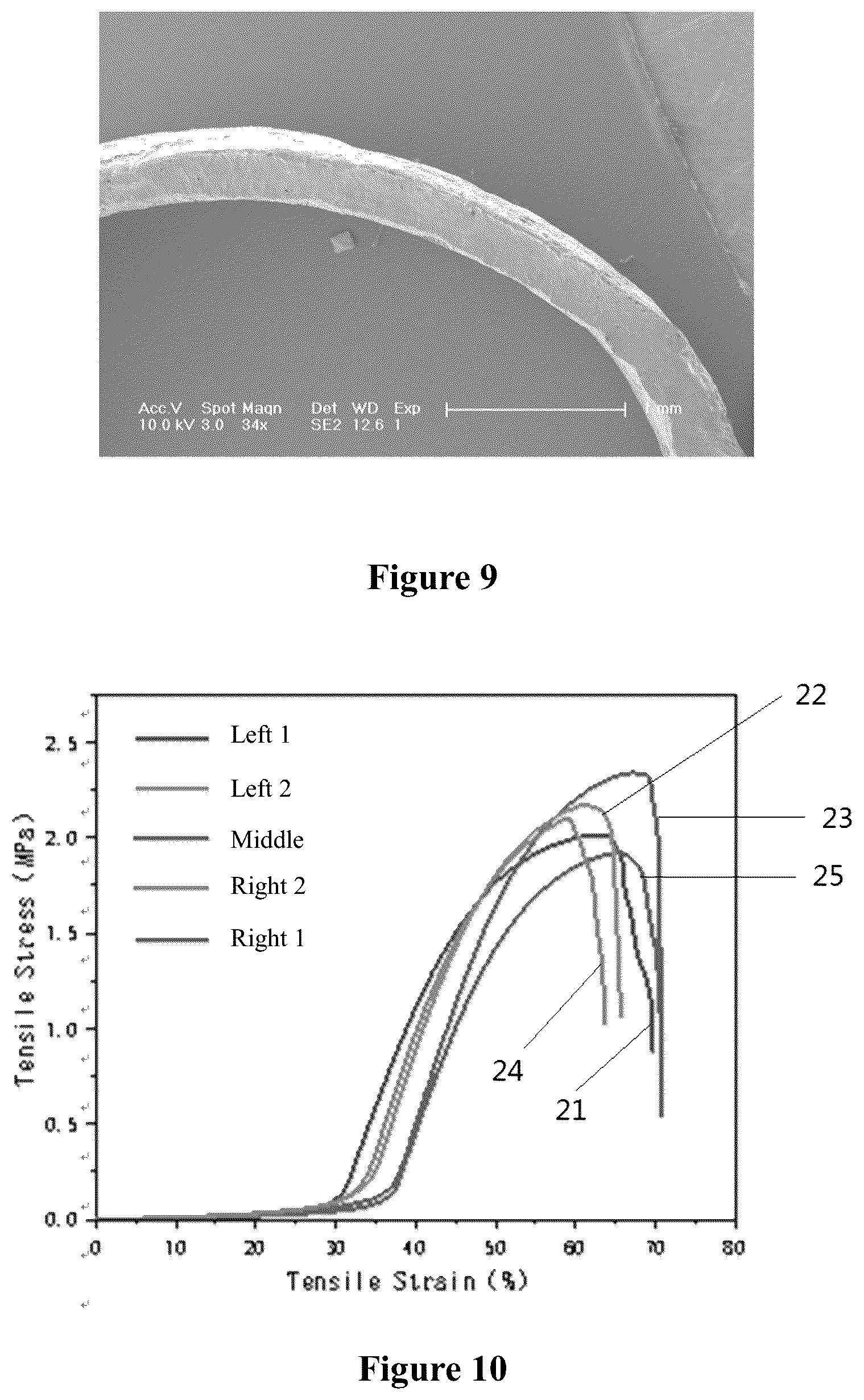 Patent US12551598 Figure 4 – Tubular material, preparation method therefor and use thereof