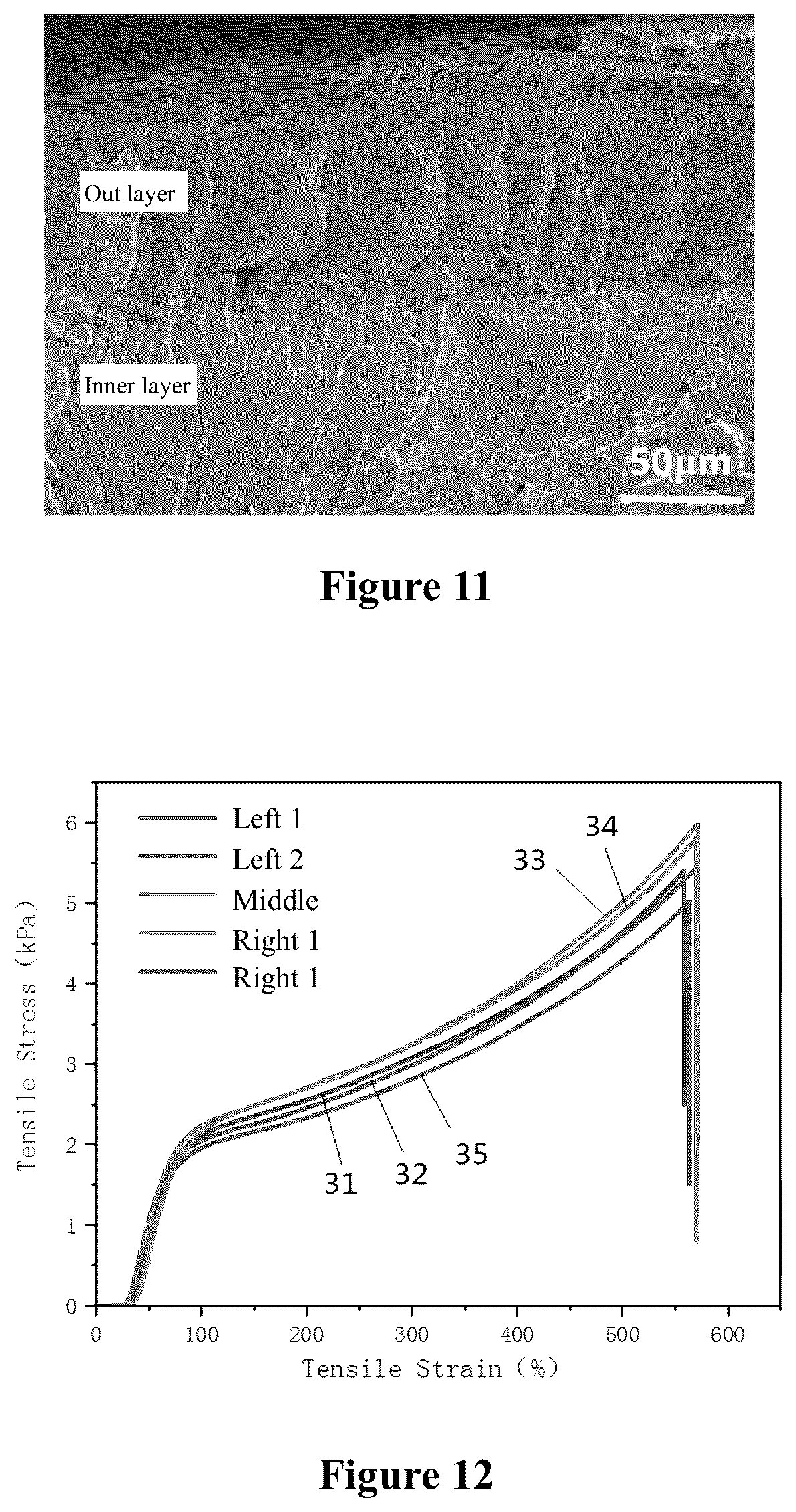 Patent US12551598 Figure 5 – Tubular material, preparation method therefor and use thereof