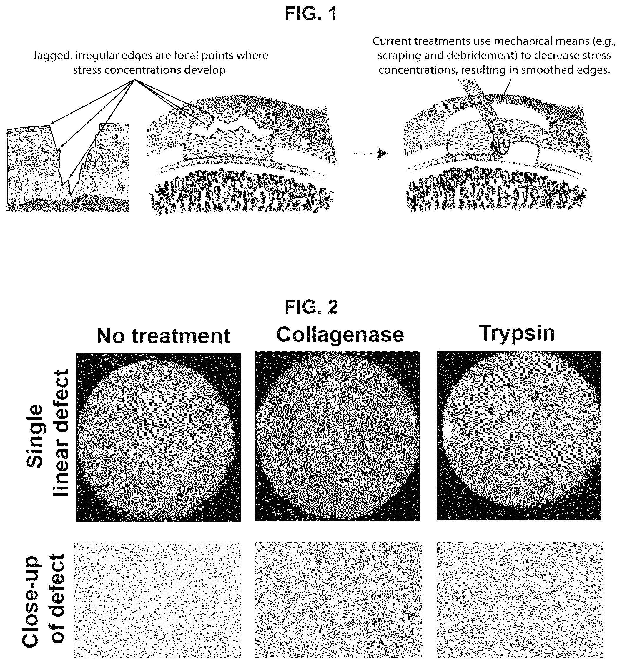 Patent US12551599 Figure 1 – Melt-and-meld approach to repair tissue defects