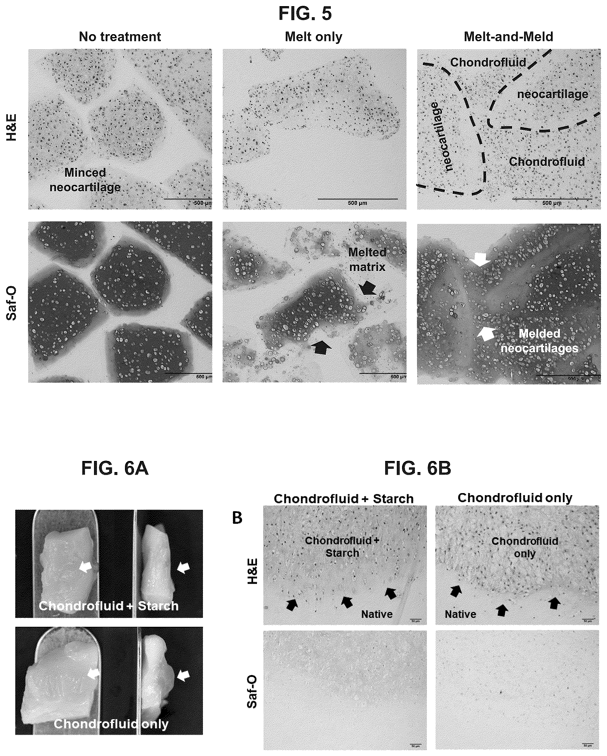 Patent US12551599 Figure 4 – Melt-and-meld approach to repair tissue defects