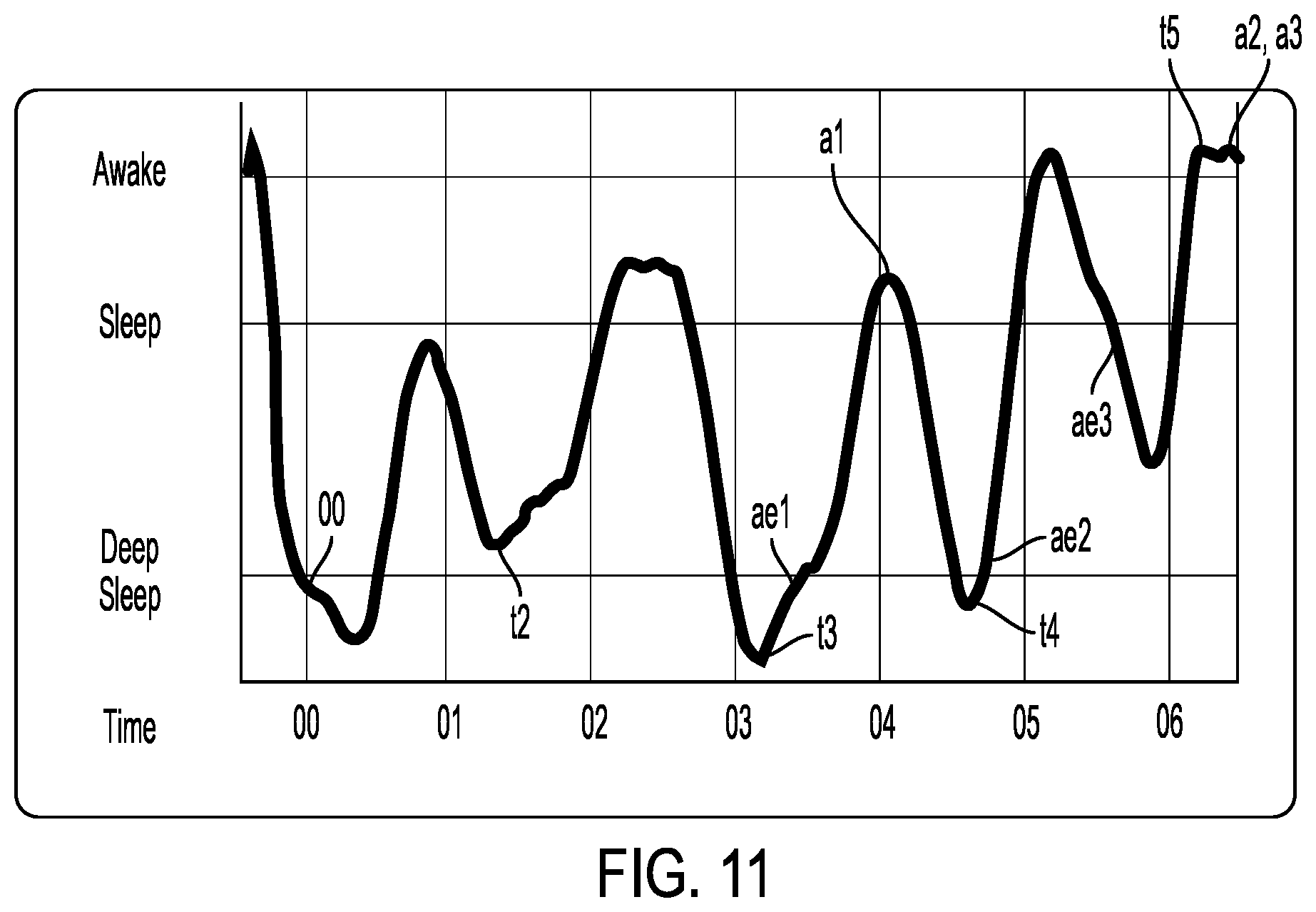 Patent US12551607 Figure 11 – Sleep tracking for alarm and therapy modifications