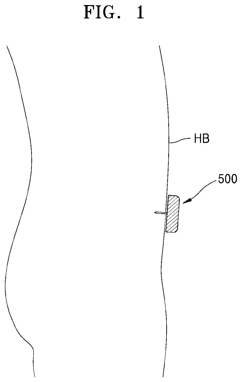 Patent US12551620 Figure 1 – Device for controlling injection of medicinal fluid