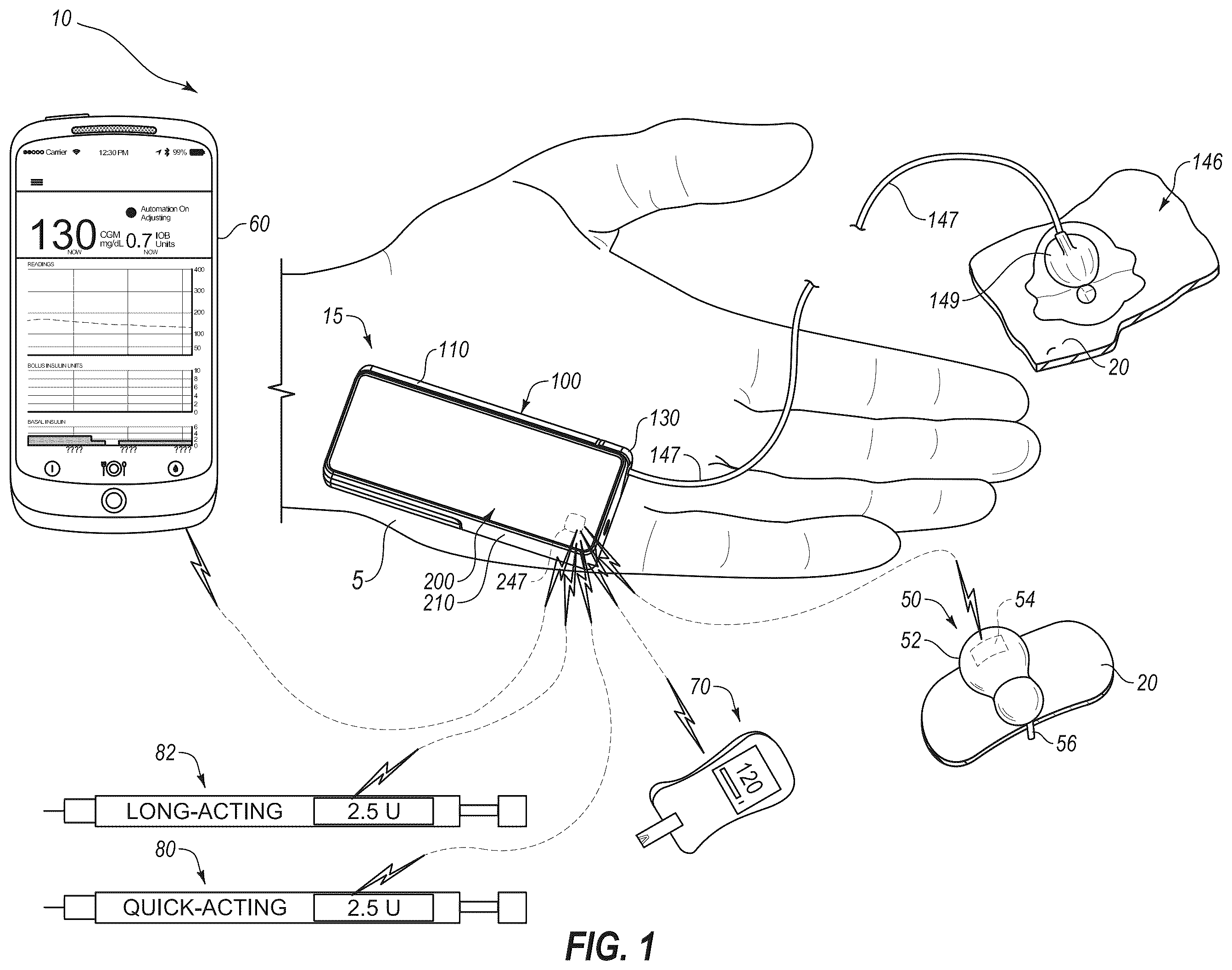 Patent US12551621 Figure 1 – System and method for adjusting insulin delivery