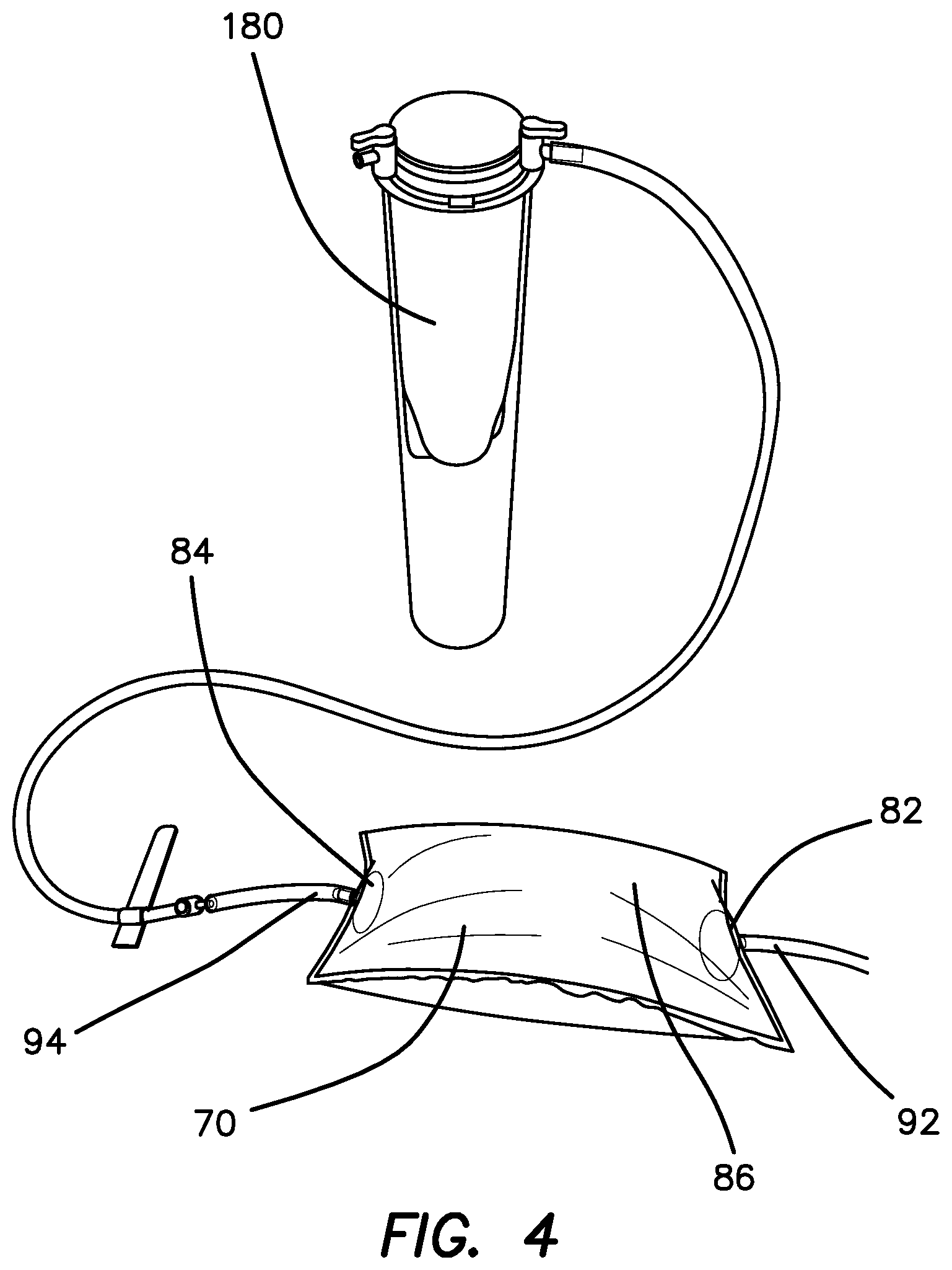 Patent US12551635 Figure 4 – Insufflation stabilization system
