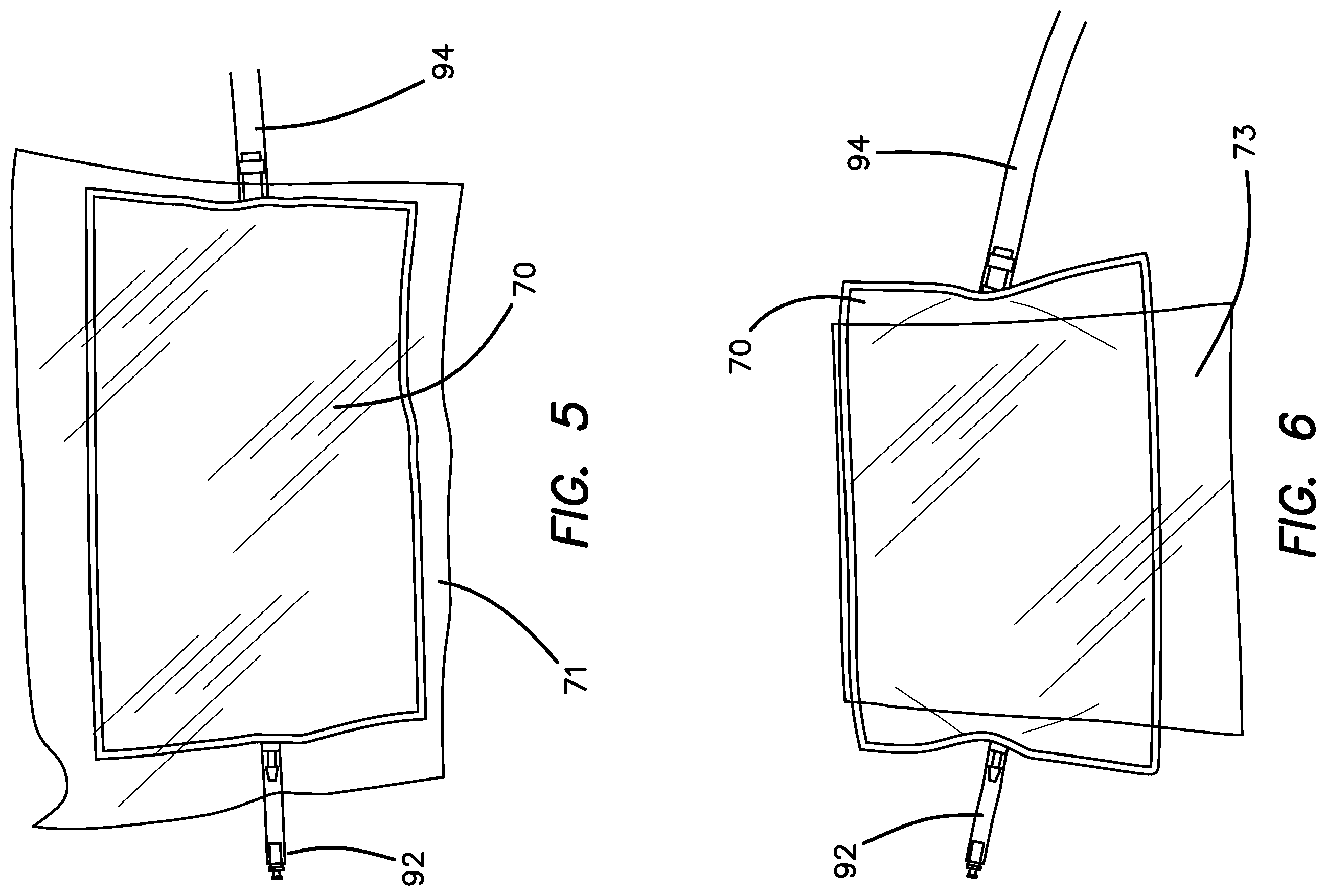 Patent US12551635 Figure 5 – Insufflation stabilization system