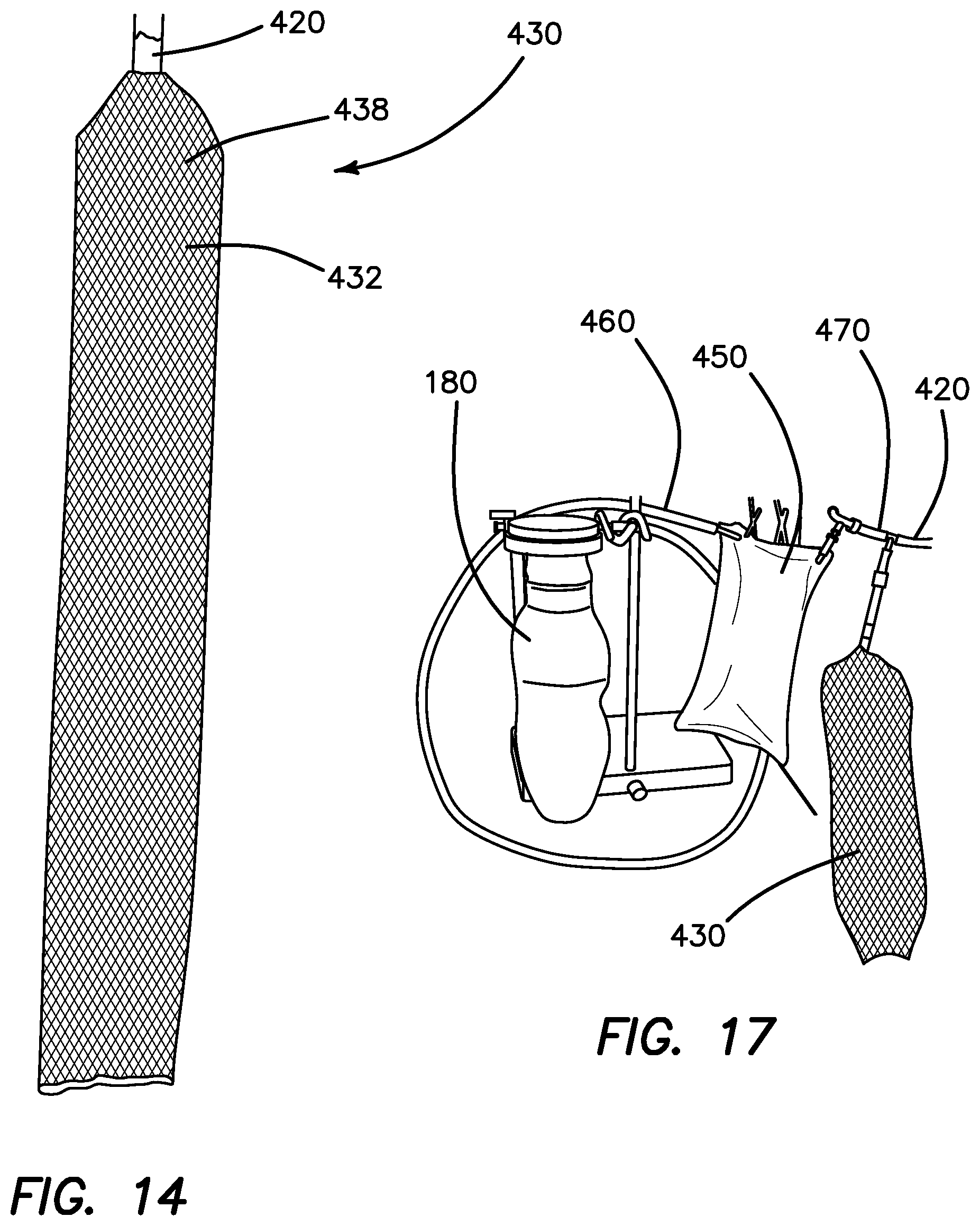 Patent US12551635 Figure 11 – Insufflation stabilization system