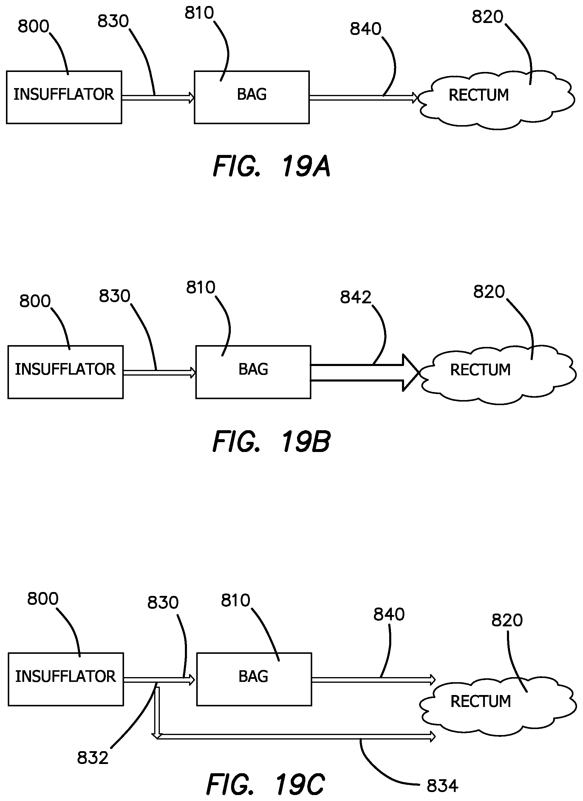 Patent US12551635 Figure 14 – Insufflation stabilization system