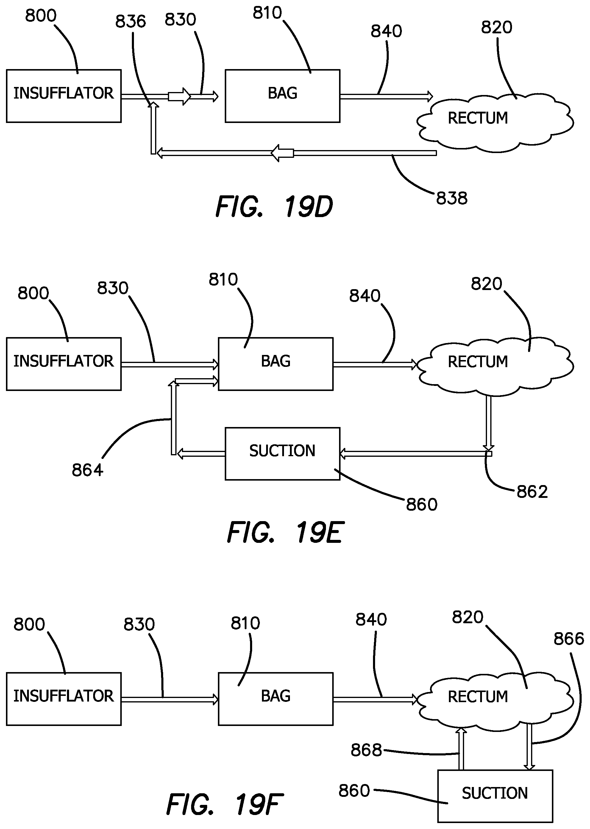 Patent US12551635 Figure 15 – Insufflation stabilization system