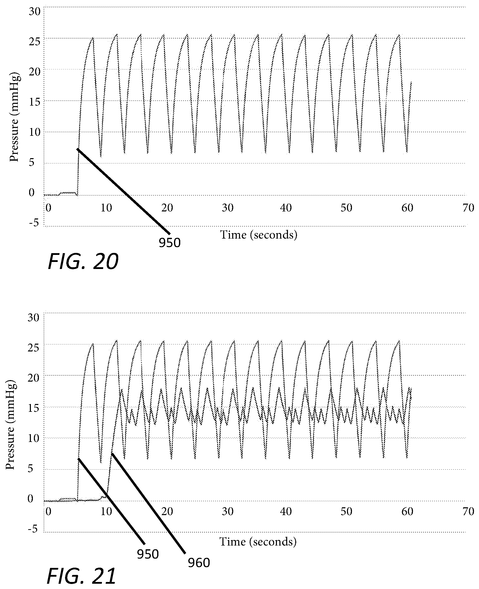 Patent US12551635 Figure 16 – Insufflation stabilization system
