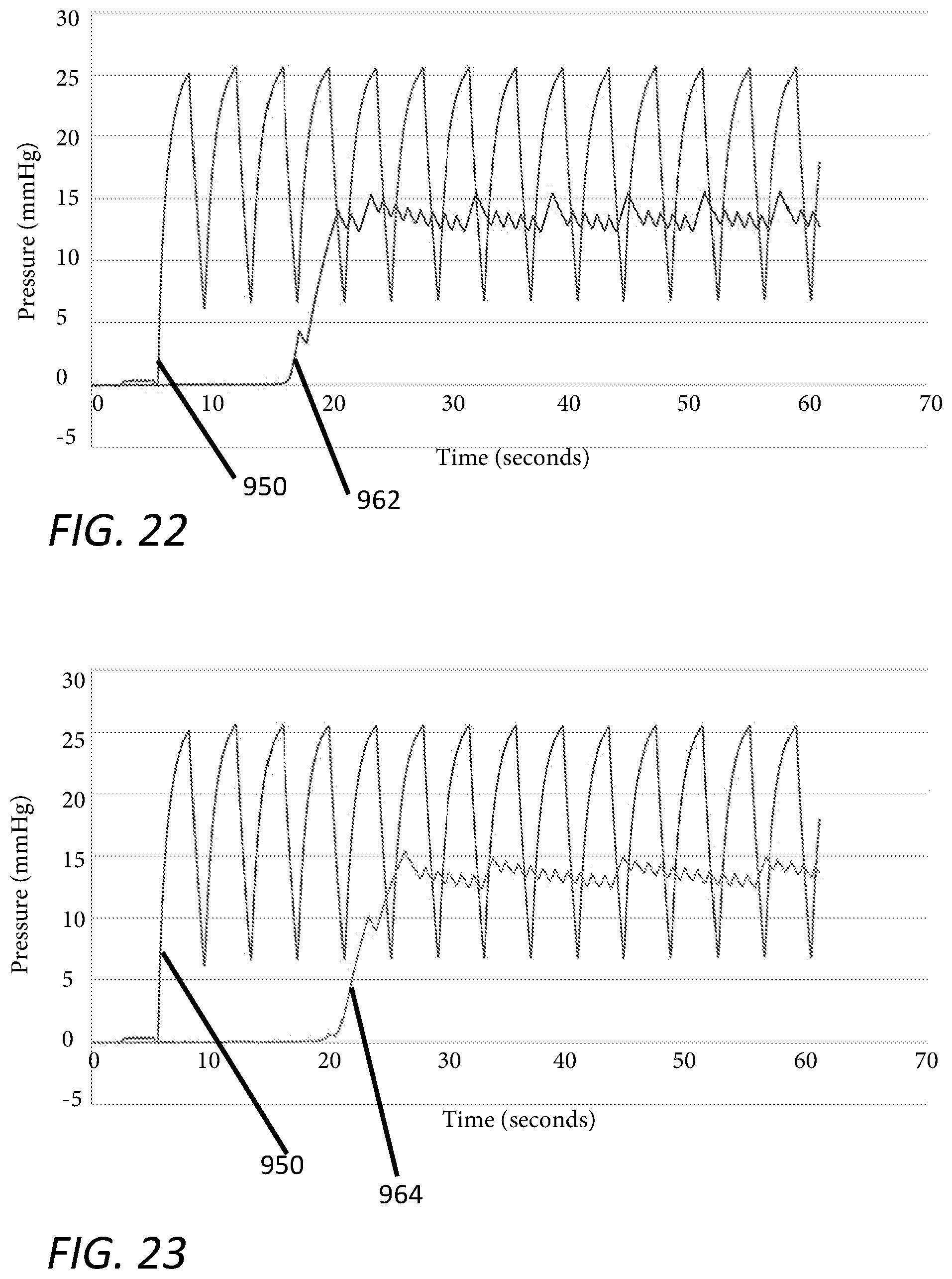 Patent US12551635 Figure 17 – Insufflation stabilization system
