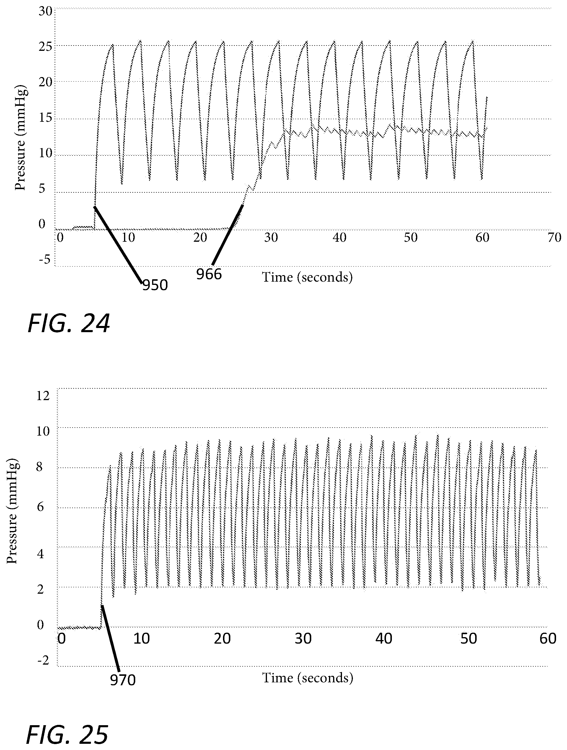 Patent US12551635 Figure 18 – Insufflation stabilization system