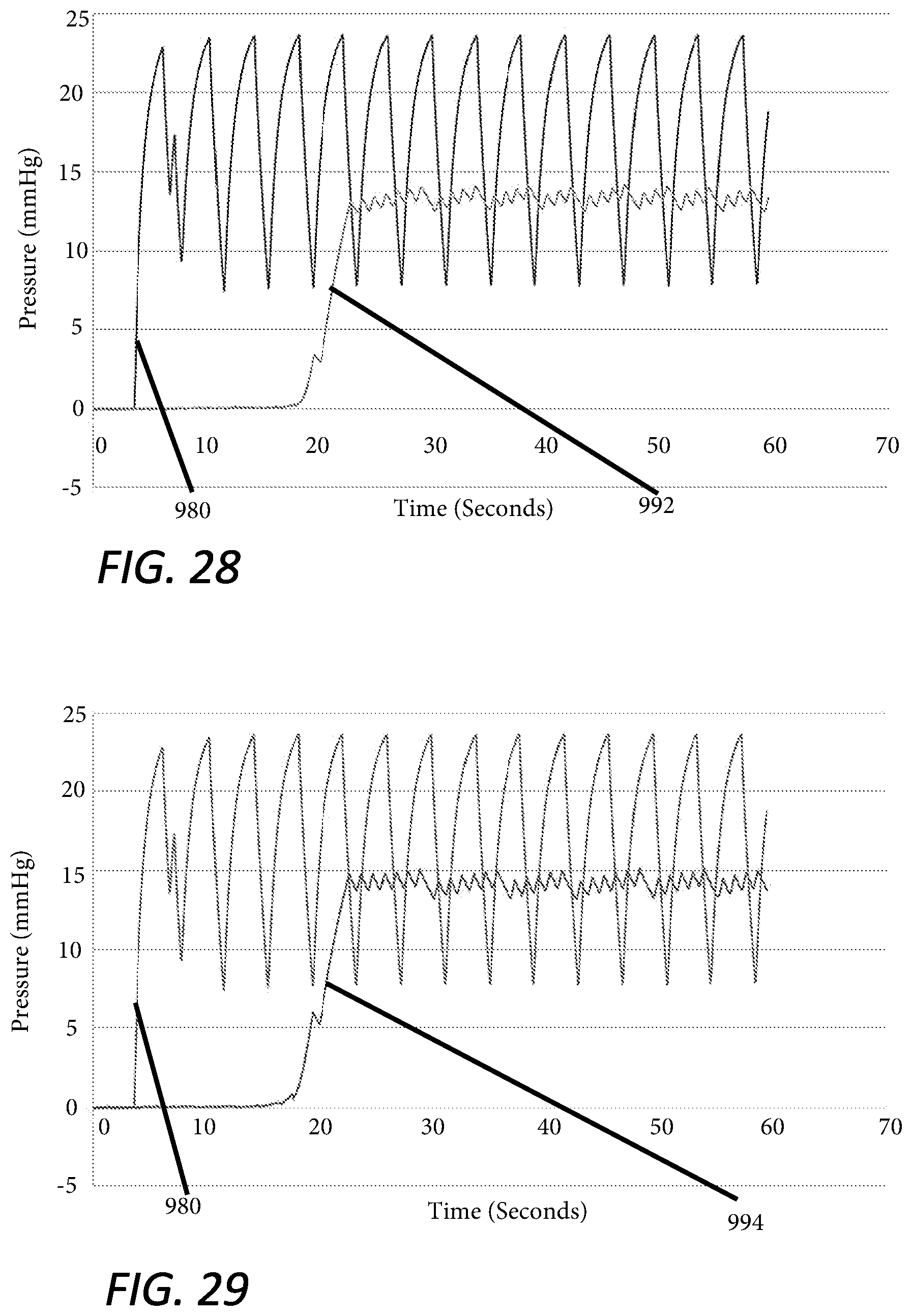 Patent US12551635 Figure 20 – Insufflation stabilization system