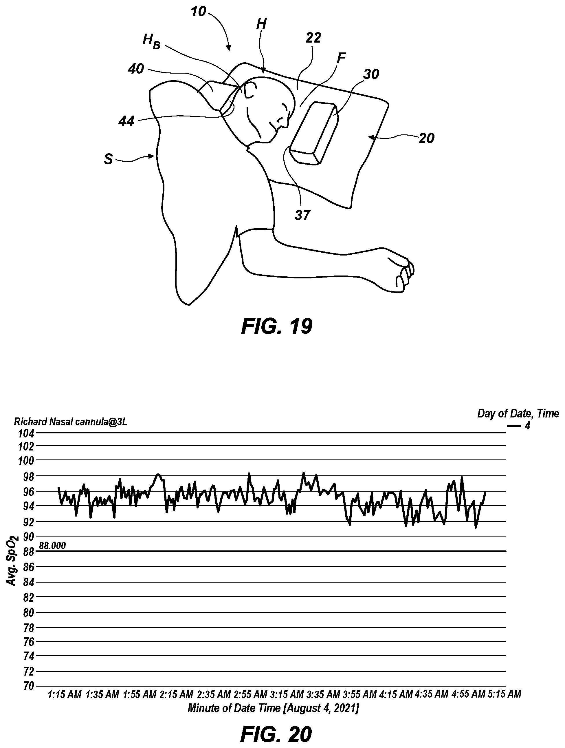 Patent US12551640 Figure 5 – Medical gas delivery