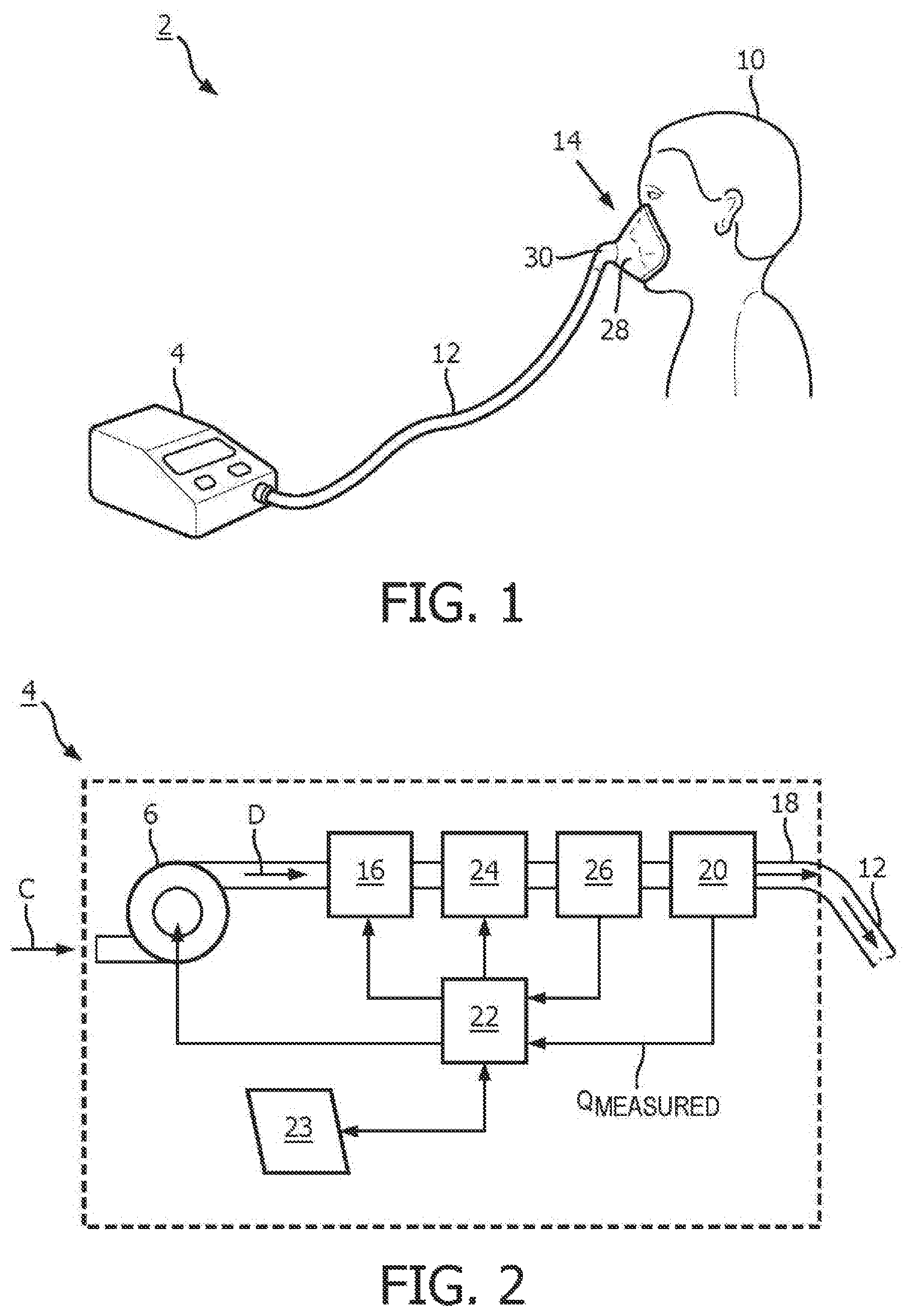 Patent US12551642 Figure 1 – Systems and methods for concurrent airway stabilization and pulmonary stretch receptor activation