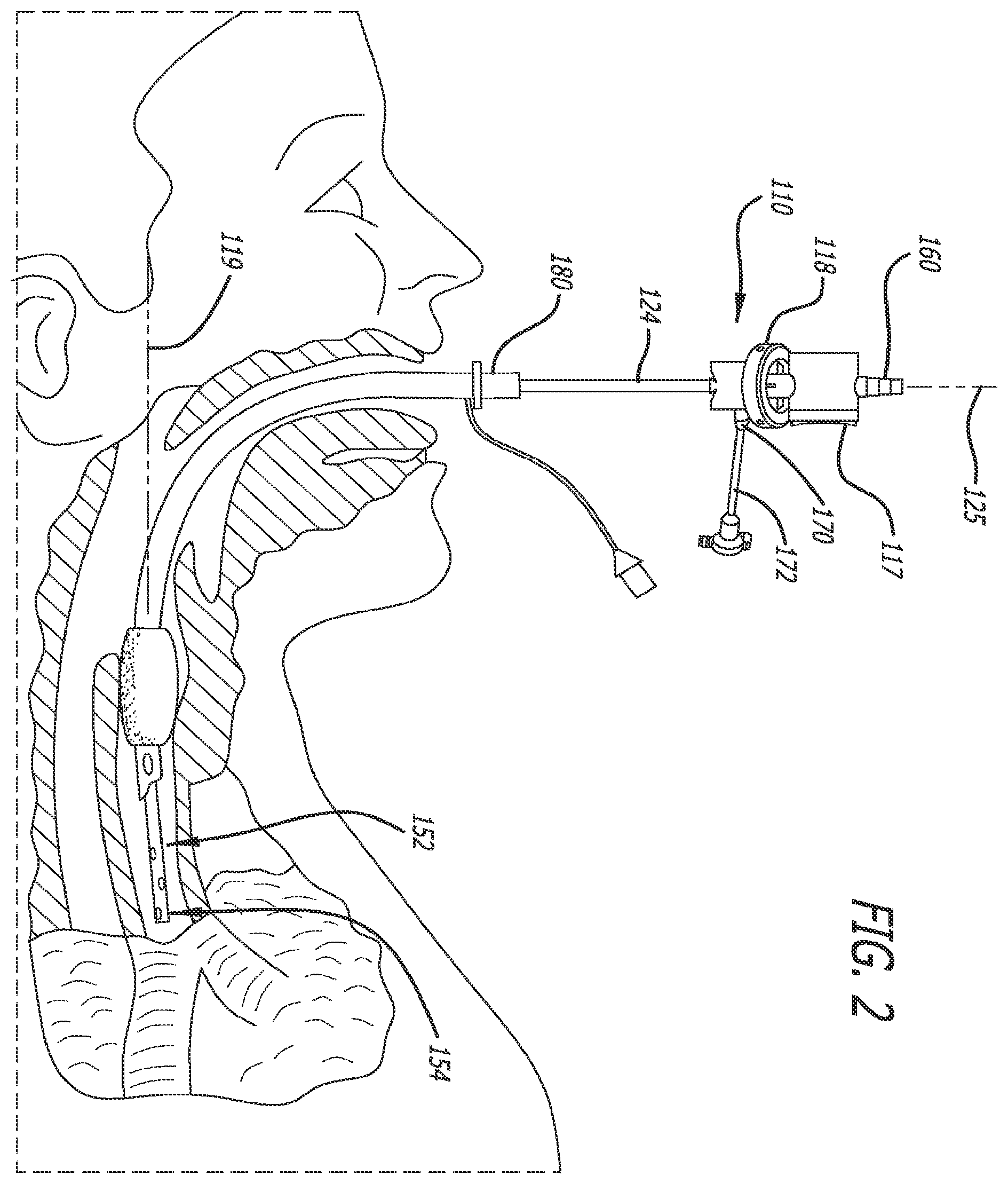 Patent US12551644 Figure 2 – Endobronchial suctioning device and medical suctioning system for intubated patients
