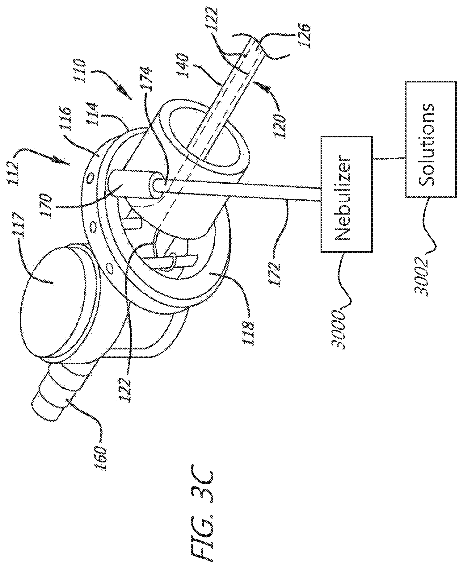 Patent US12551644 Figure 4 – Endobronchial suctioning device and medical suctioning system for intubated patients