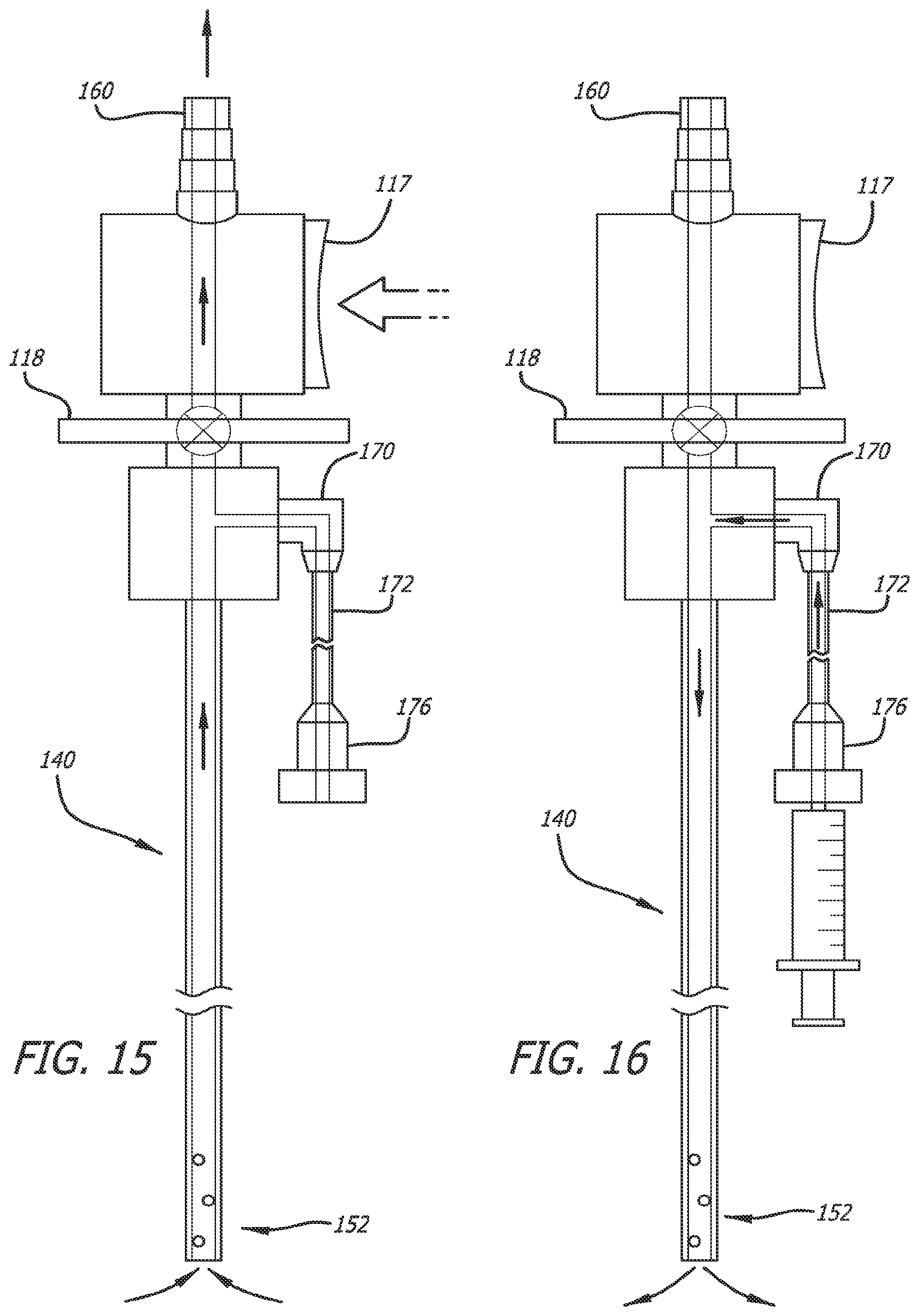 Patent US12551644 Figure 11 – Endobronchial suctioning device and medical suctioning system for intubated patients