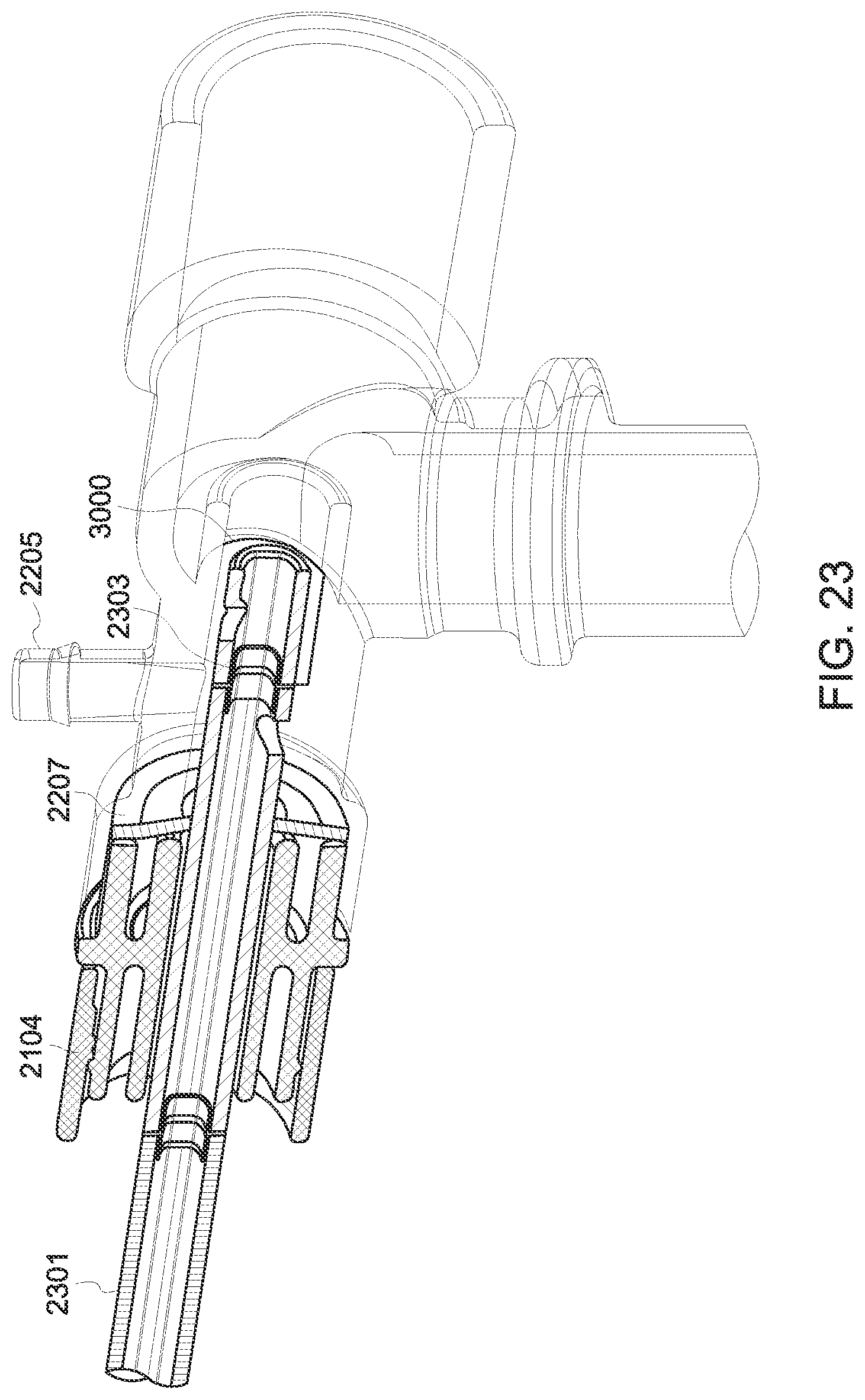 Patent US12551644 Figure 19 – Endobronchial suctioning device and medical suctioning system for intubated patients