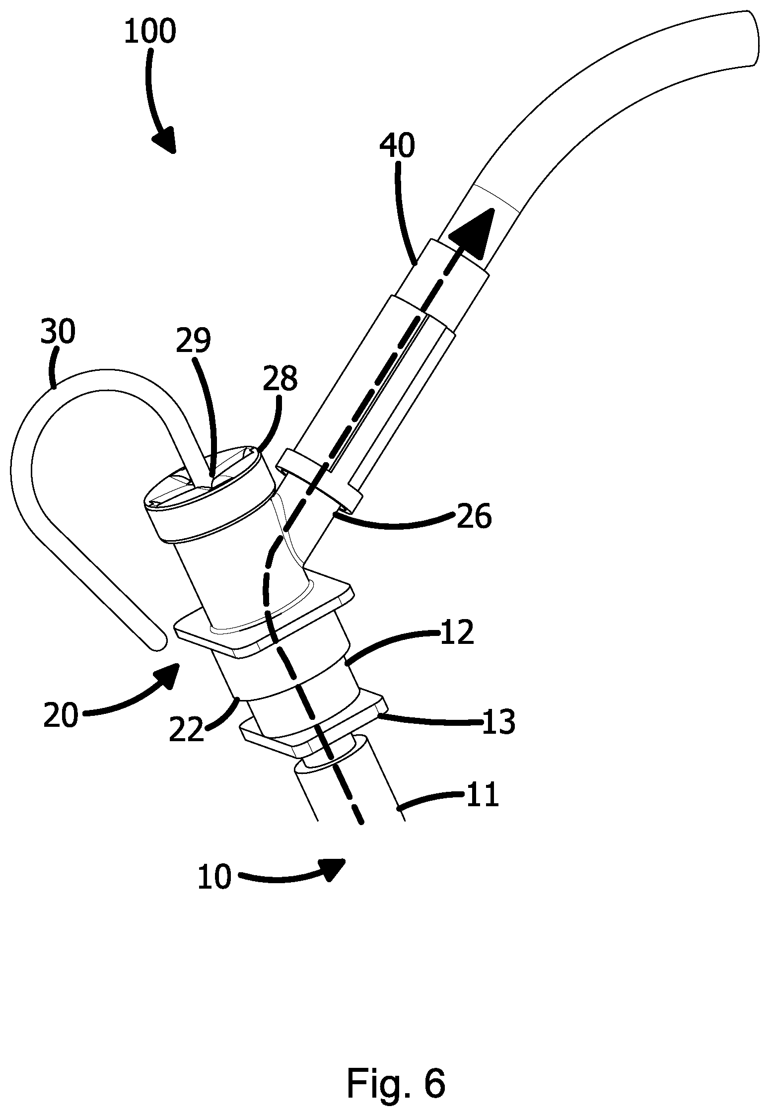 Patent US12551645 Figure 6 – Intubation assembly