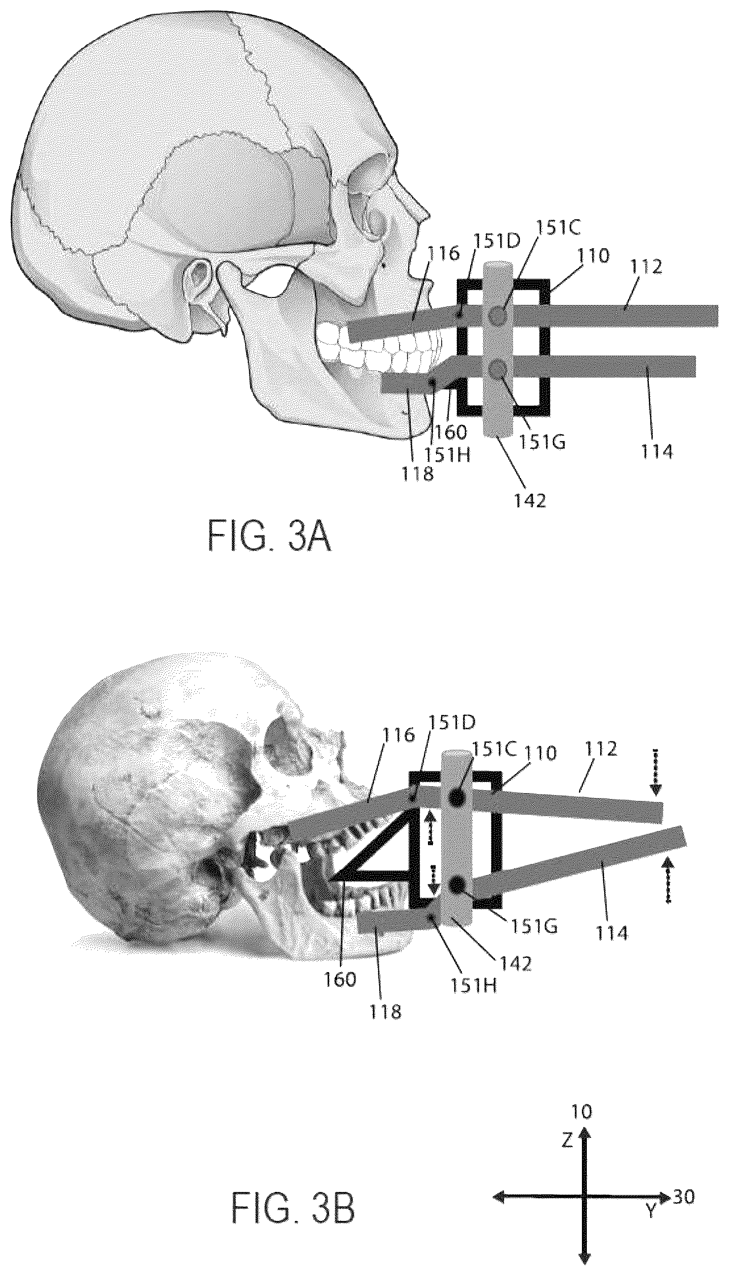 Patent US12551646 Figure 3 – Mouthpiece