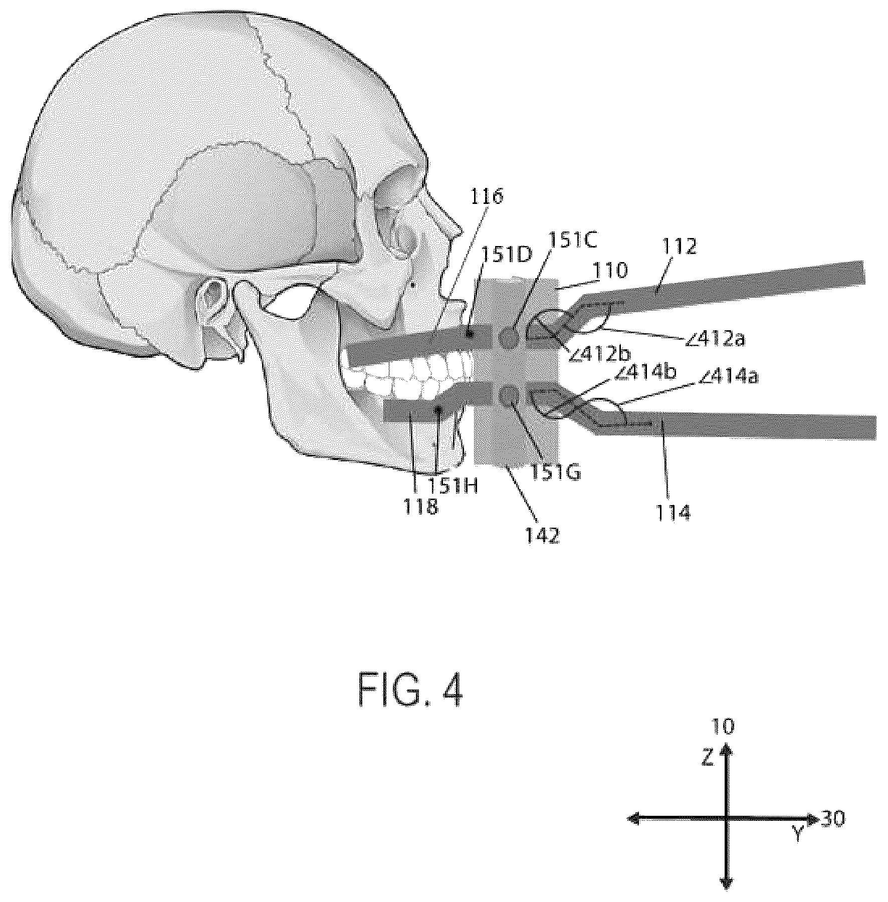Patent US12551646 Figure 4 – Mouthpiece