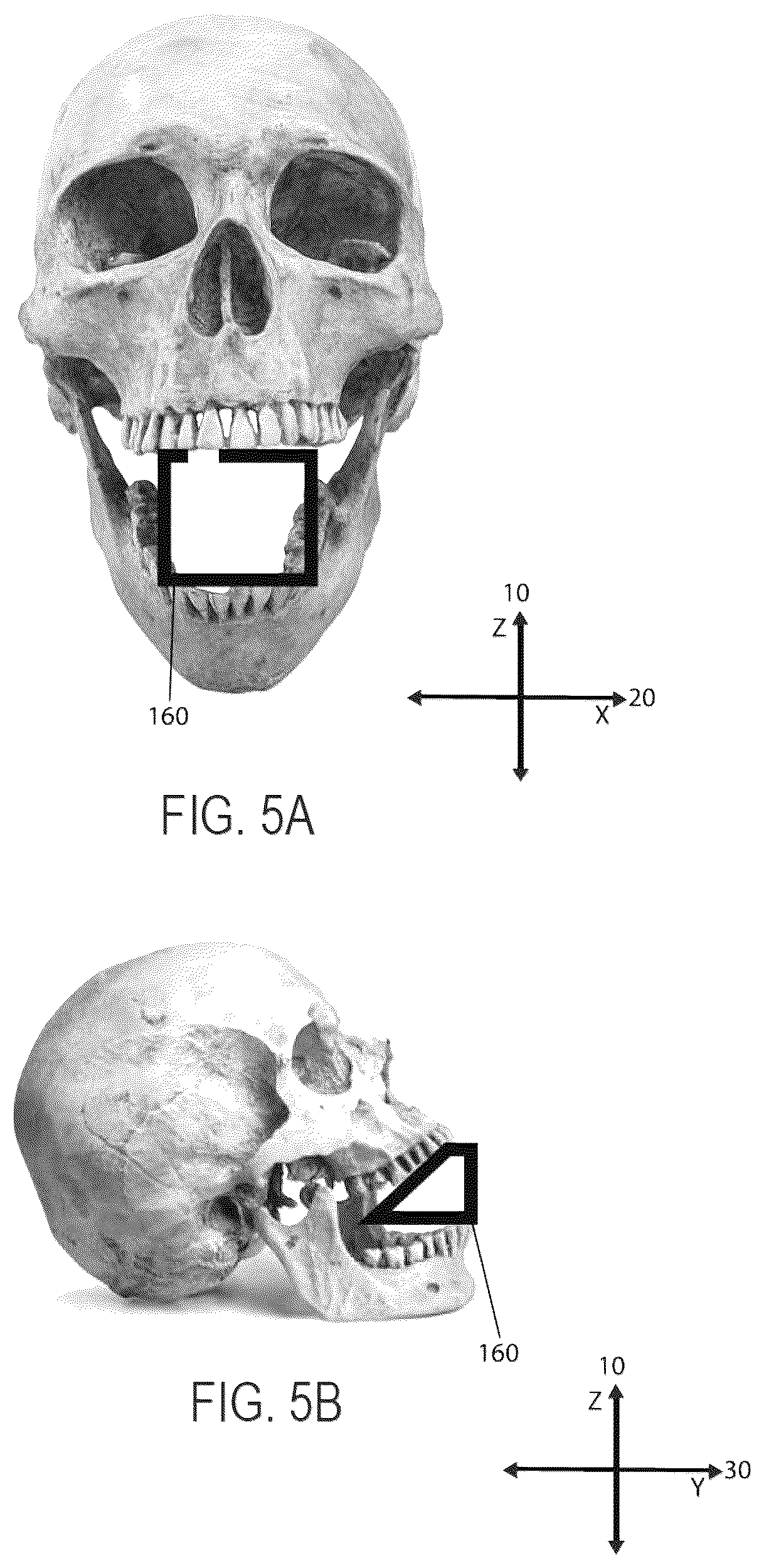 Patent US12551646 Figure 5 – Mouthpiece
