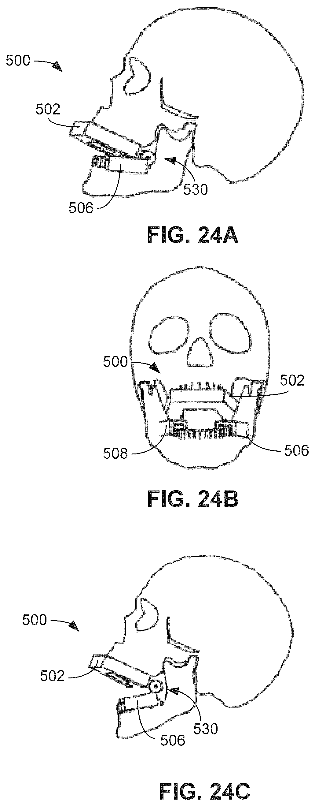 Patent US12551646 Figure 17 – Mouthpiece