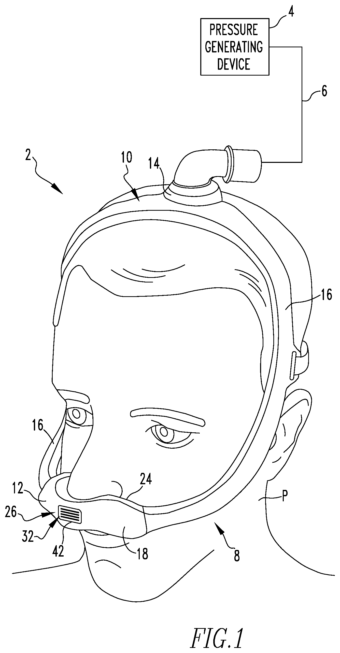 Patent US12551648 Figure 1 – Exhaust arrangement for patient interface device and patient interface including same