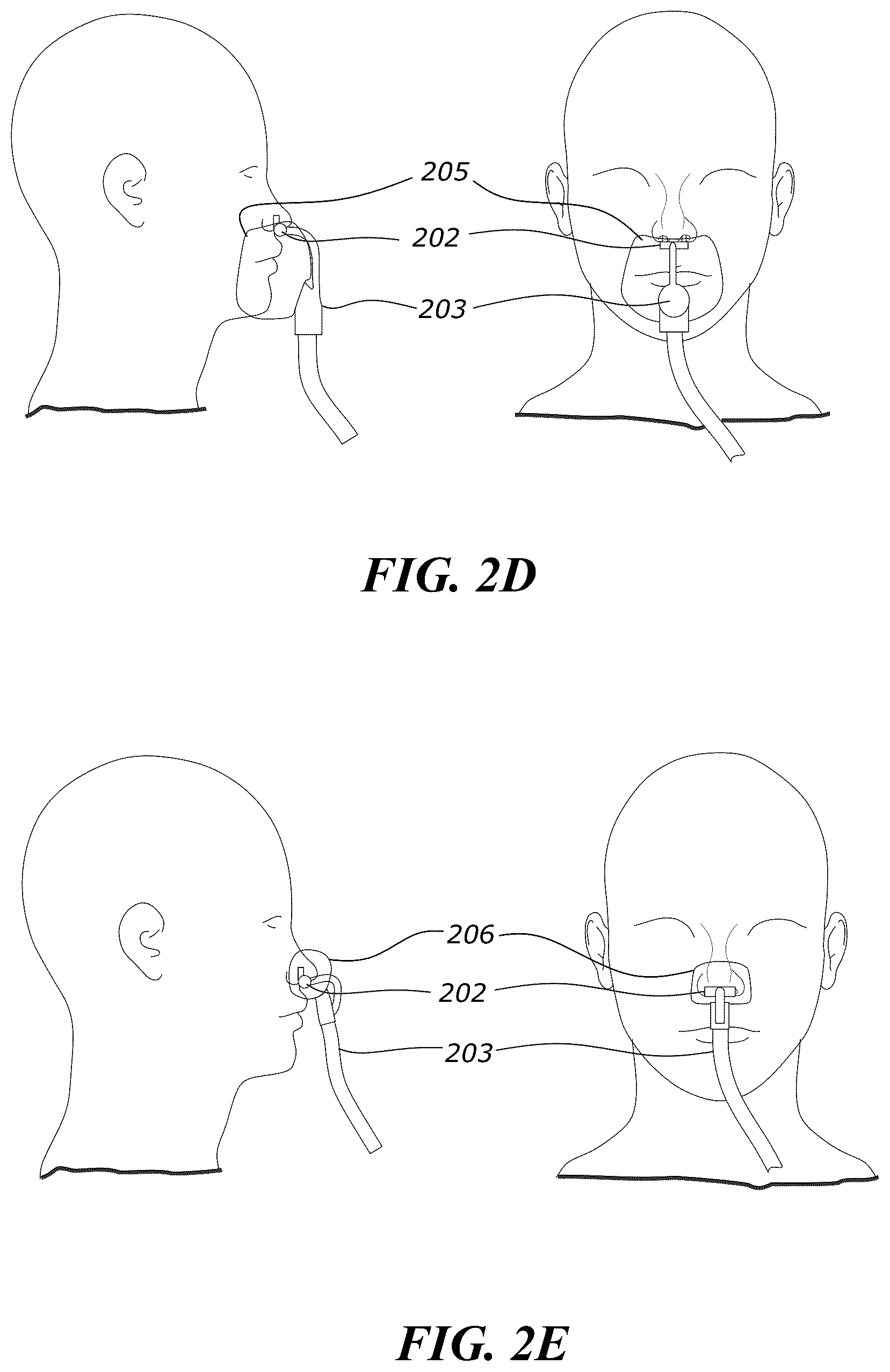 Patent US12551652 Figure 3 – System and method for non-invasive ventilation