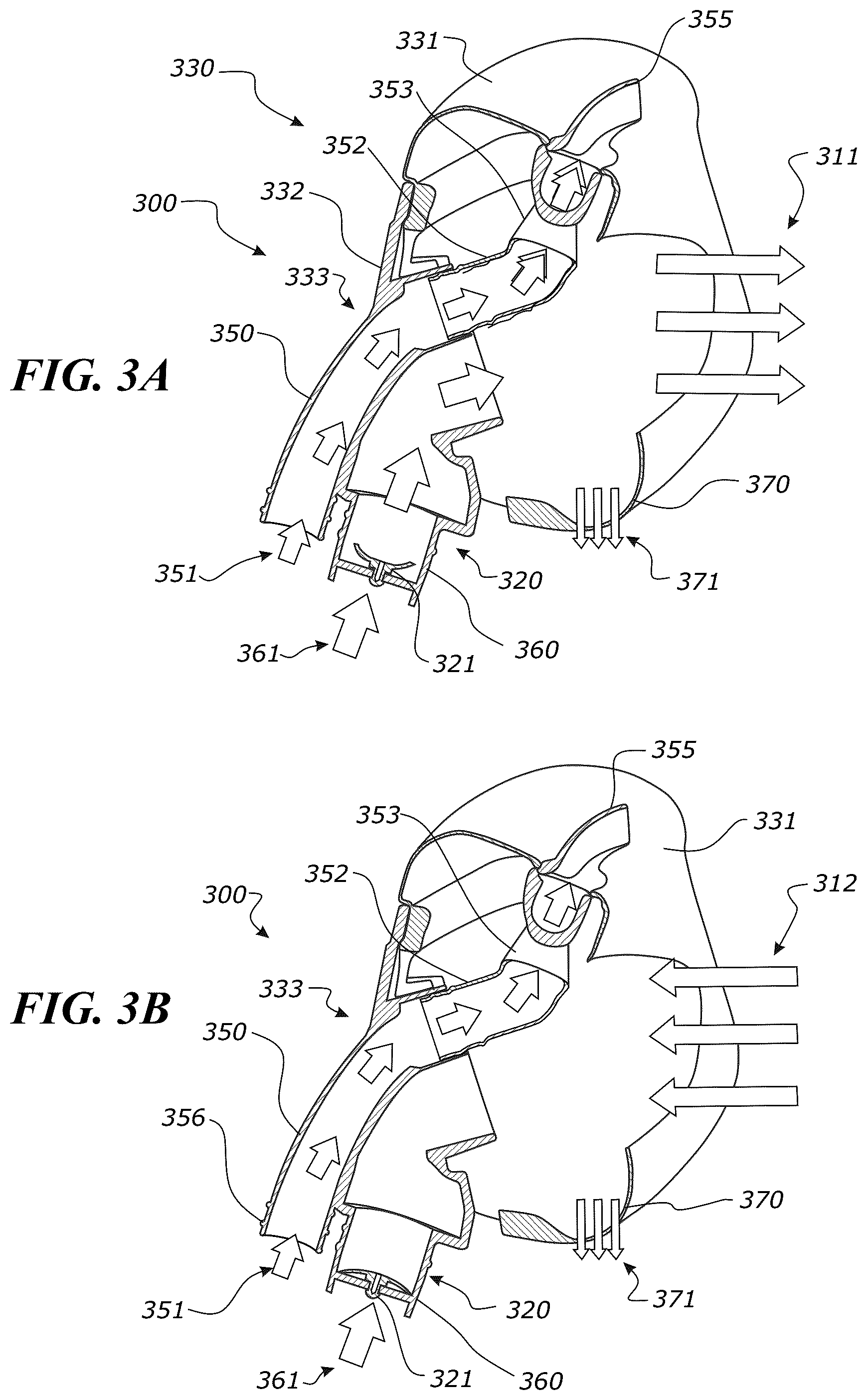Patent US12551652 Figure 4 – System and method for non-invasive ventilation