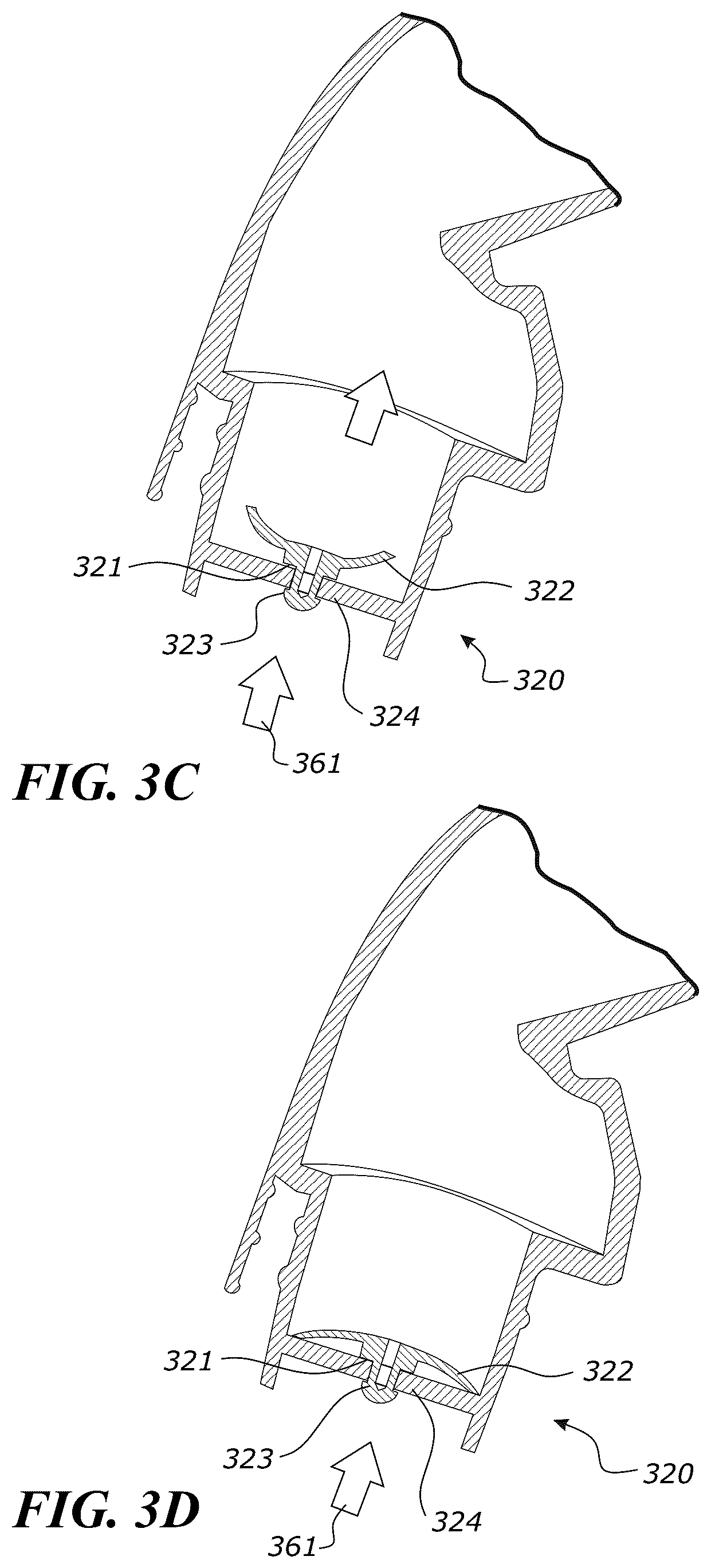 Patent US12551652 Figure 5 – System and method for non-invasive ventilation