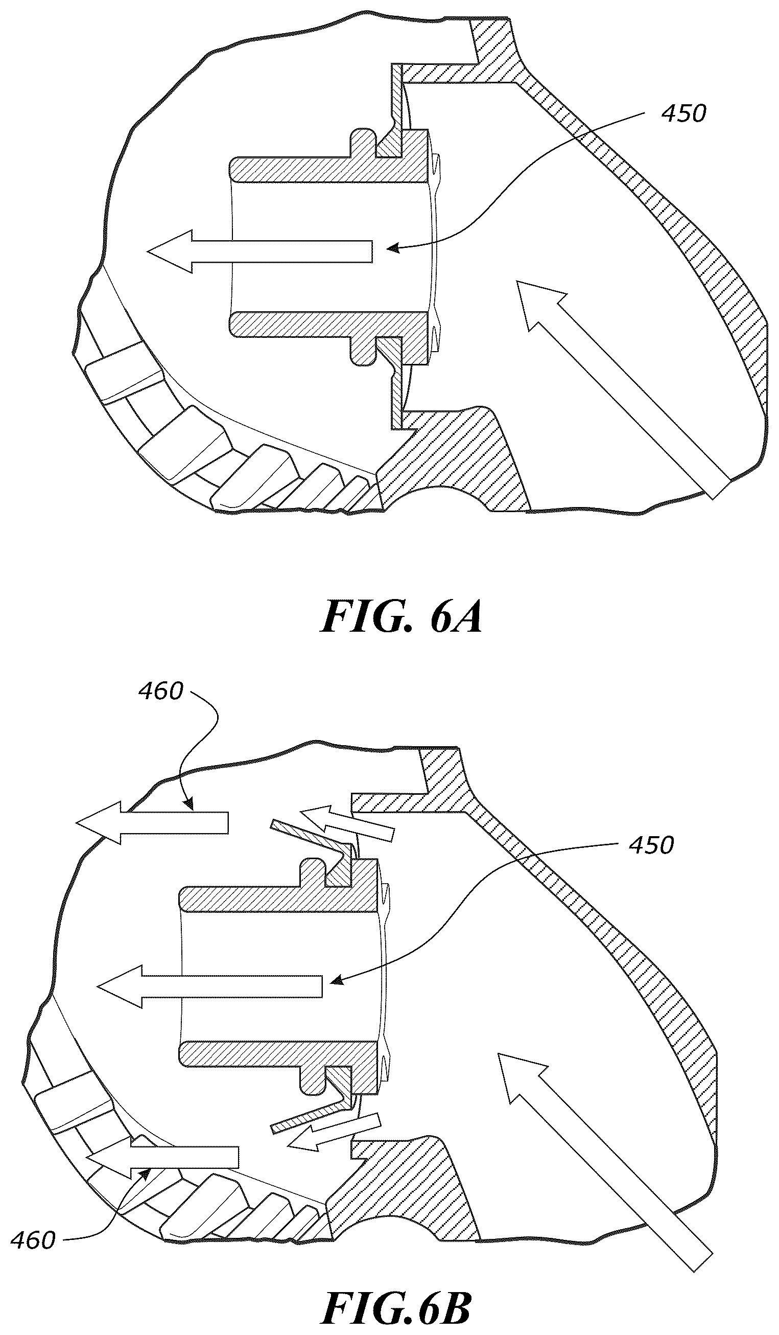 Patent US12551652 Figure 8 – System and method for non-invasive ventilation