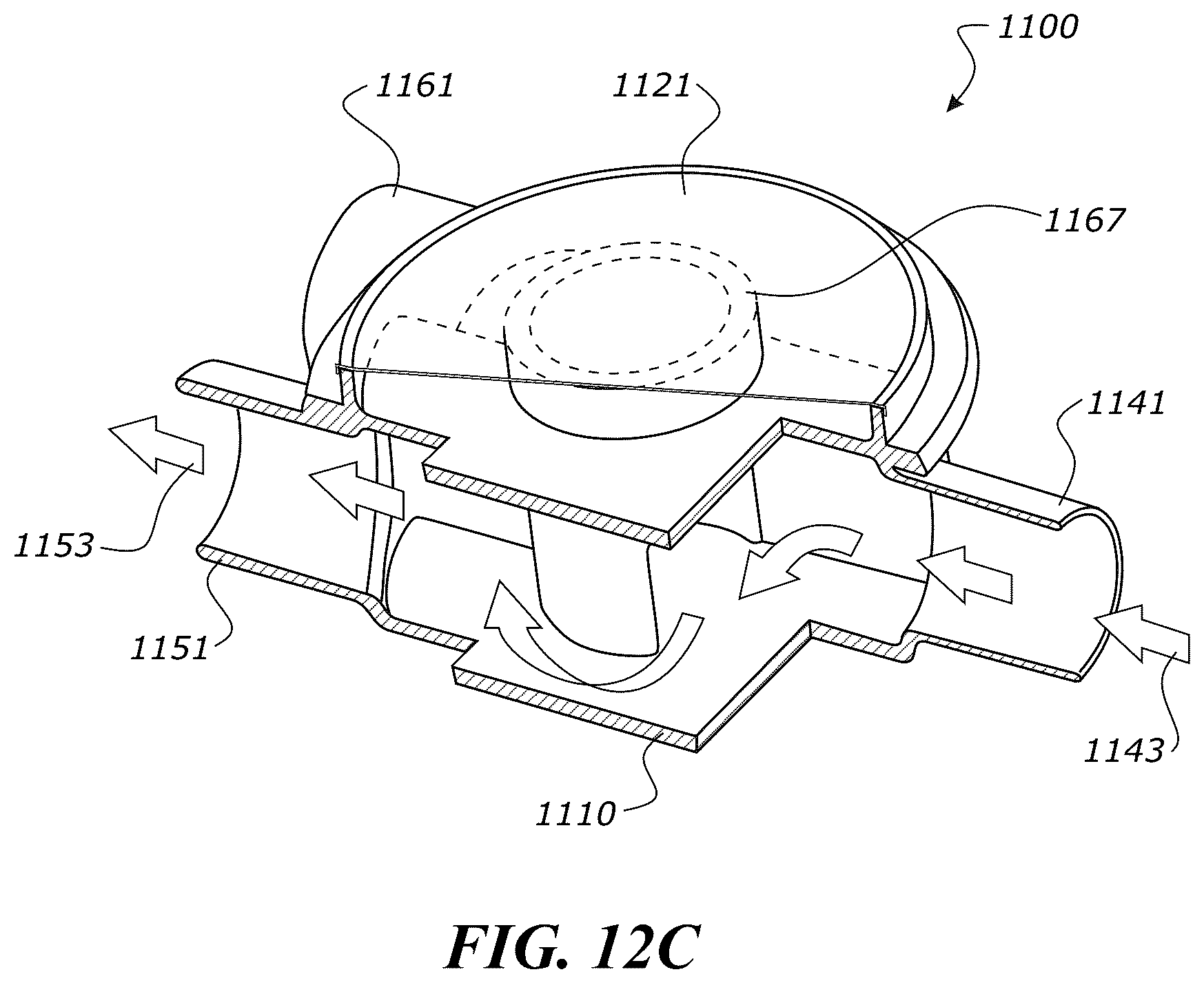 Patent US12551652 Figure 15 – System and method for non-invasive ventilation