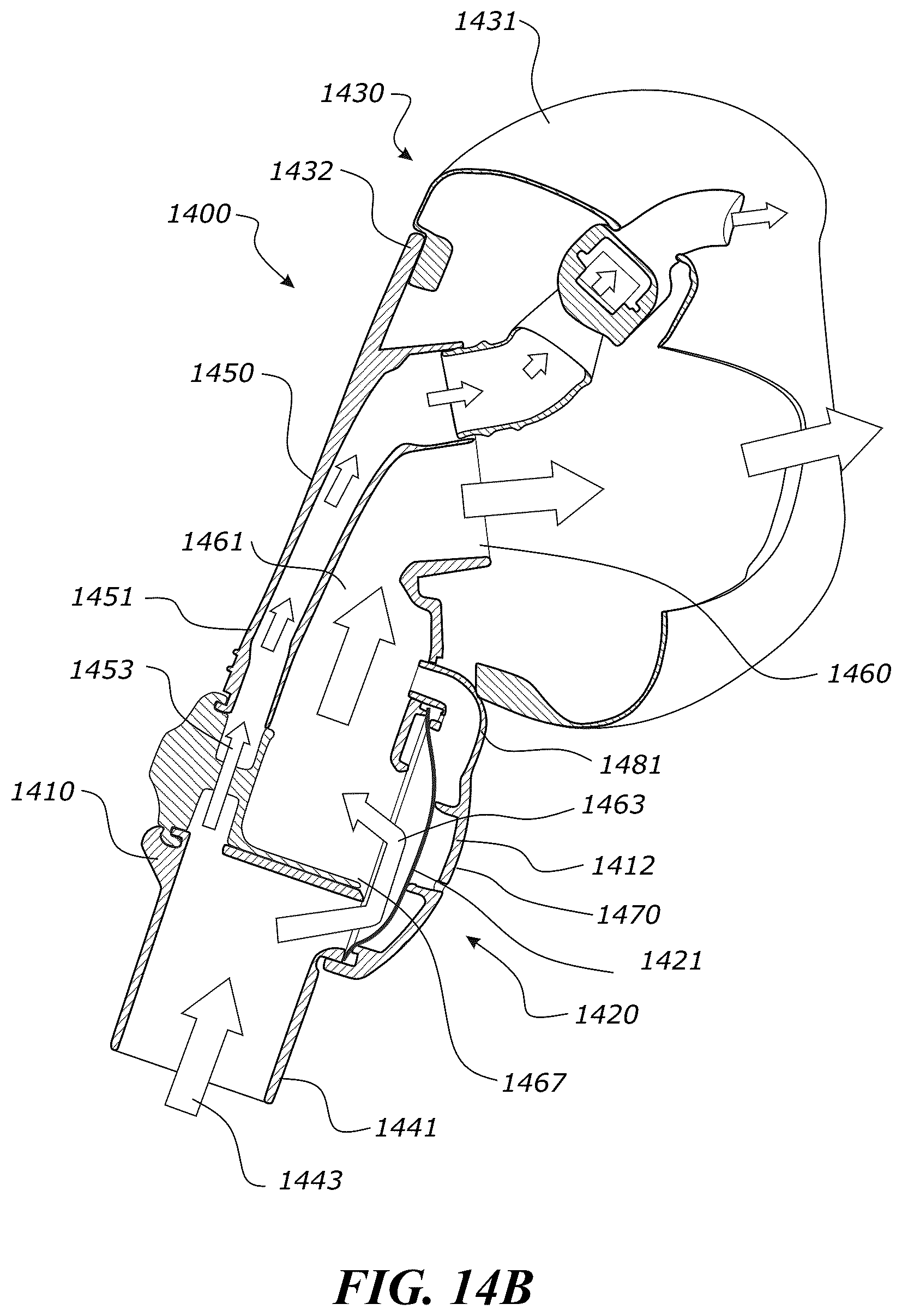 Patent US12551652 Figure 20 – System and method for non-invasive ventilation