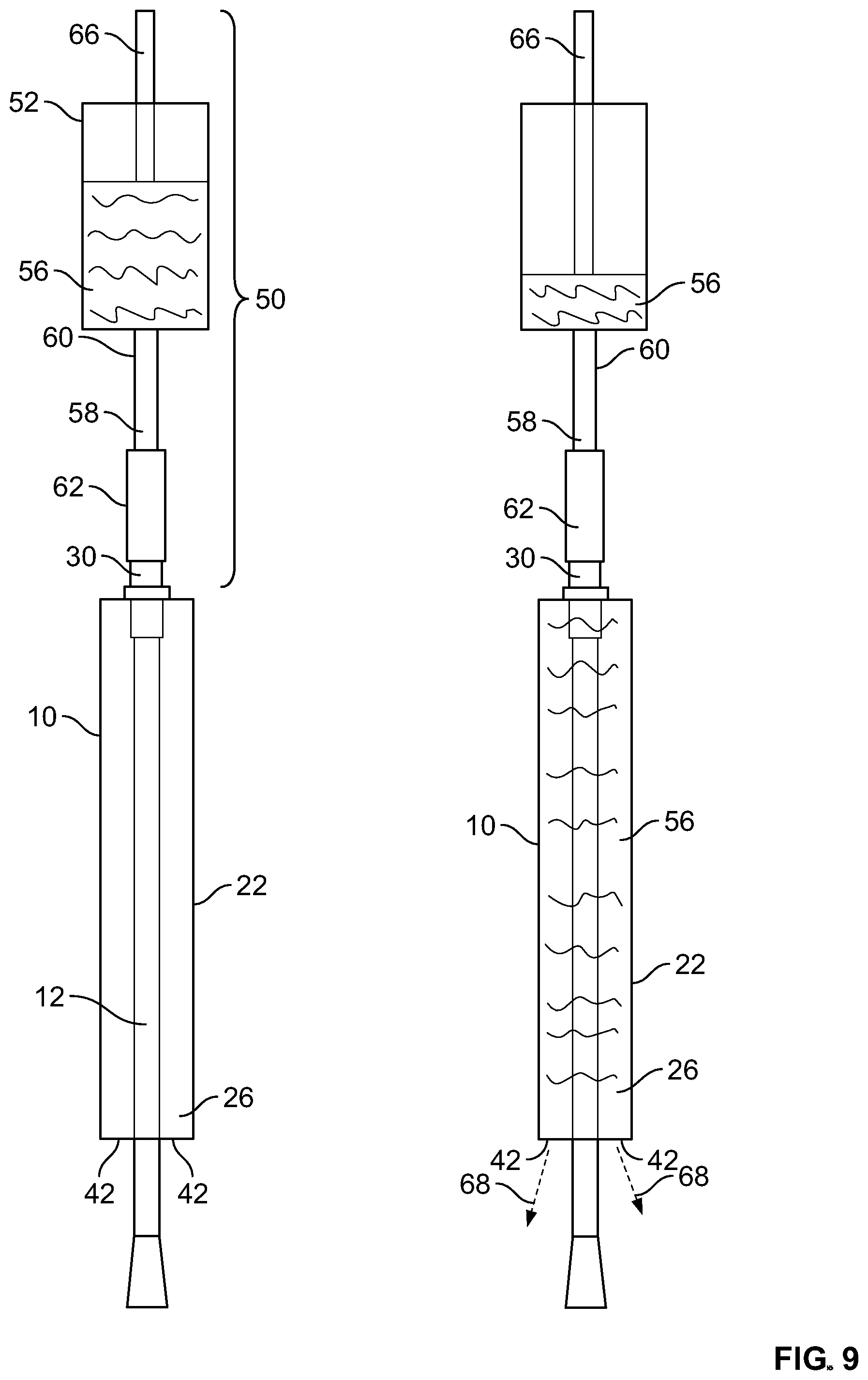 Patent US12551653 Figure 4 – Methods of making sleeved hydrophilic catheter products