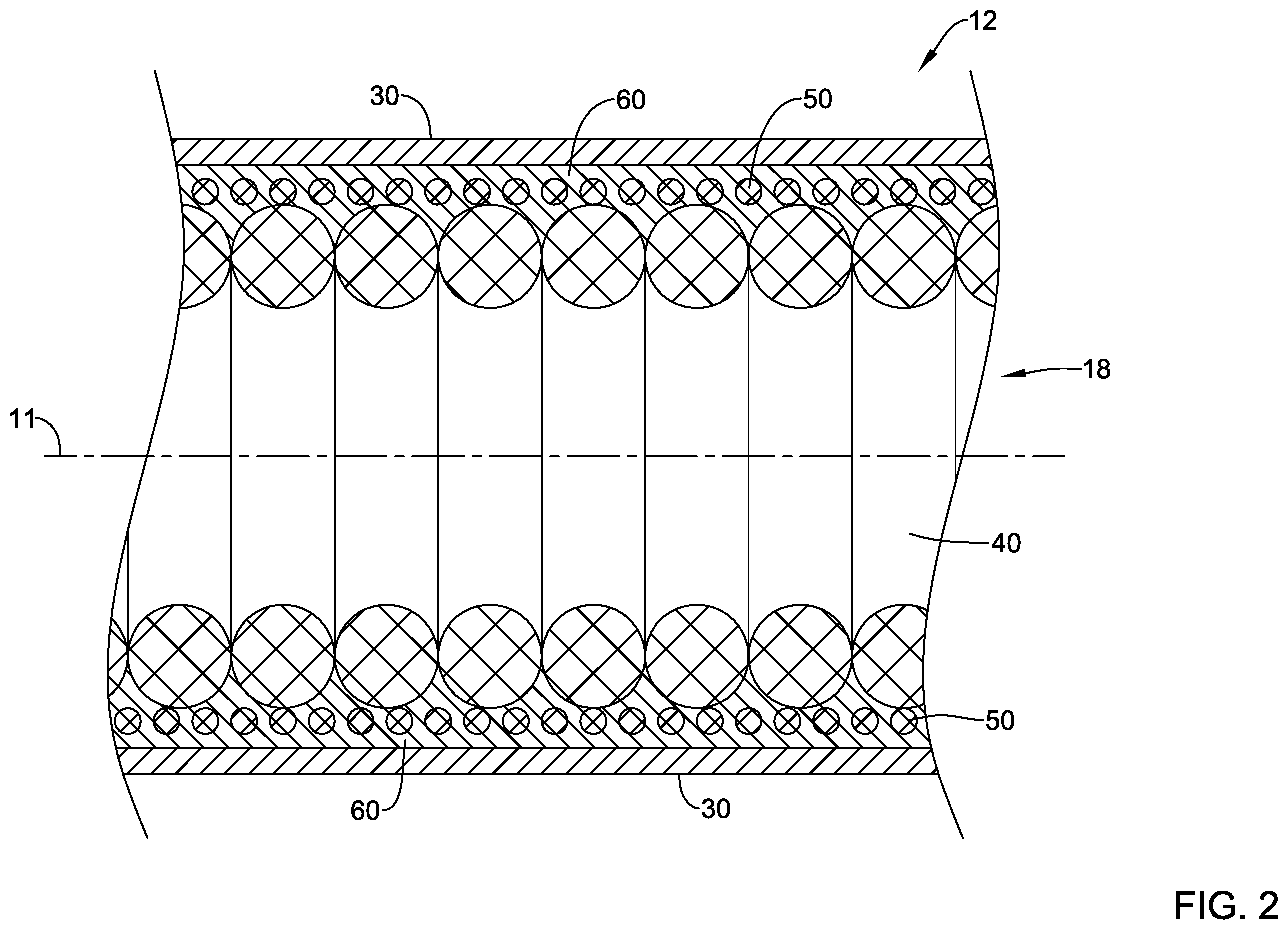 Patent US12551654 Figure 2 – Compression resistant sheath